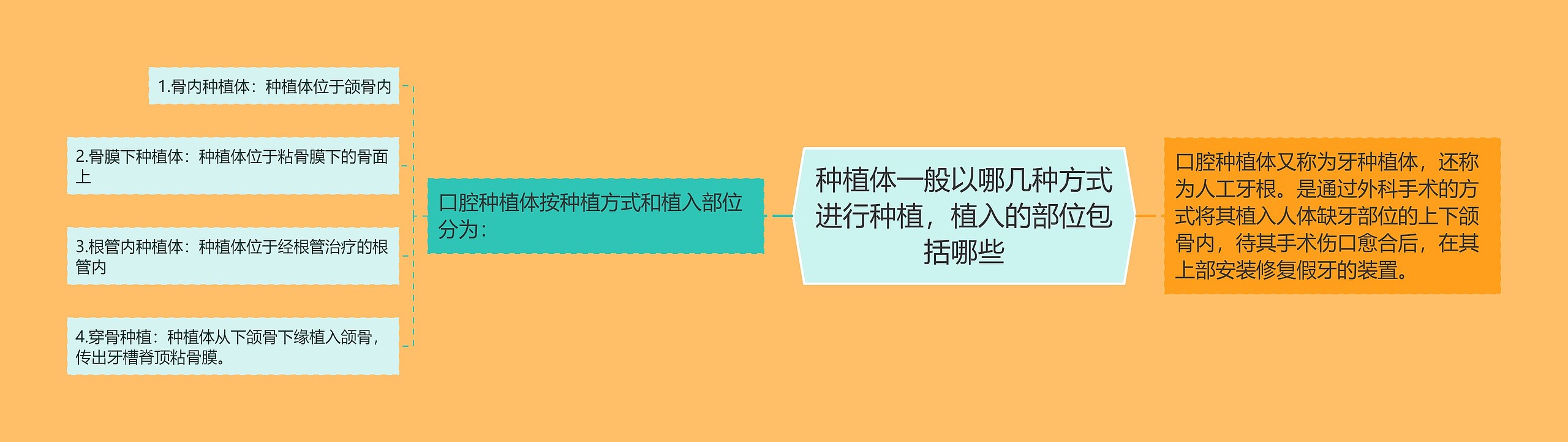 种植体一般以哪几种方式进行种植，植入的部位包括哪些思维导图