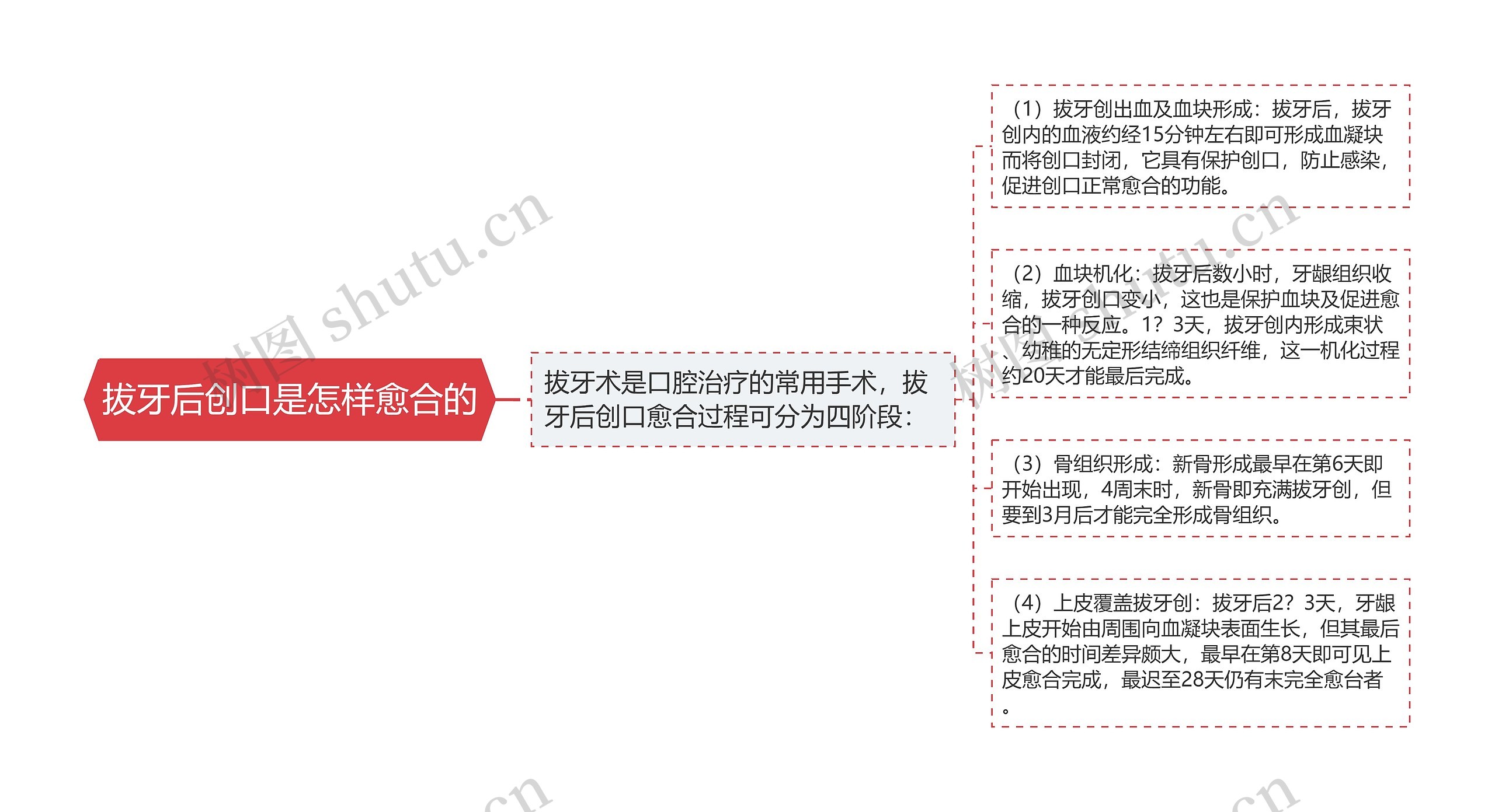 拔牙后创口是怎样愈合的思维导图