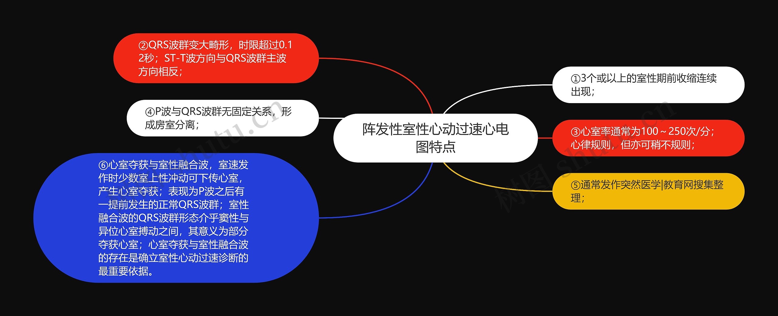 阵发性室性心动过速心电图特点