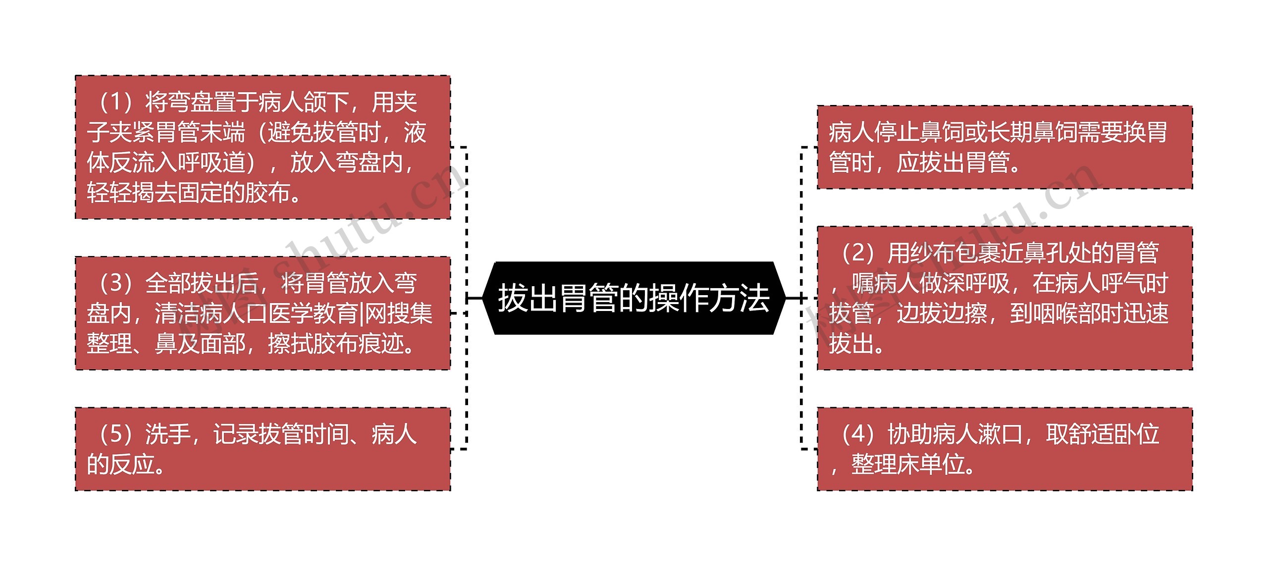 拔出胃管的操作方法