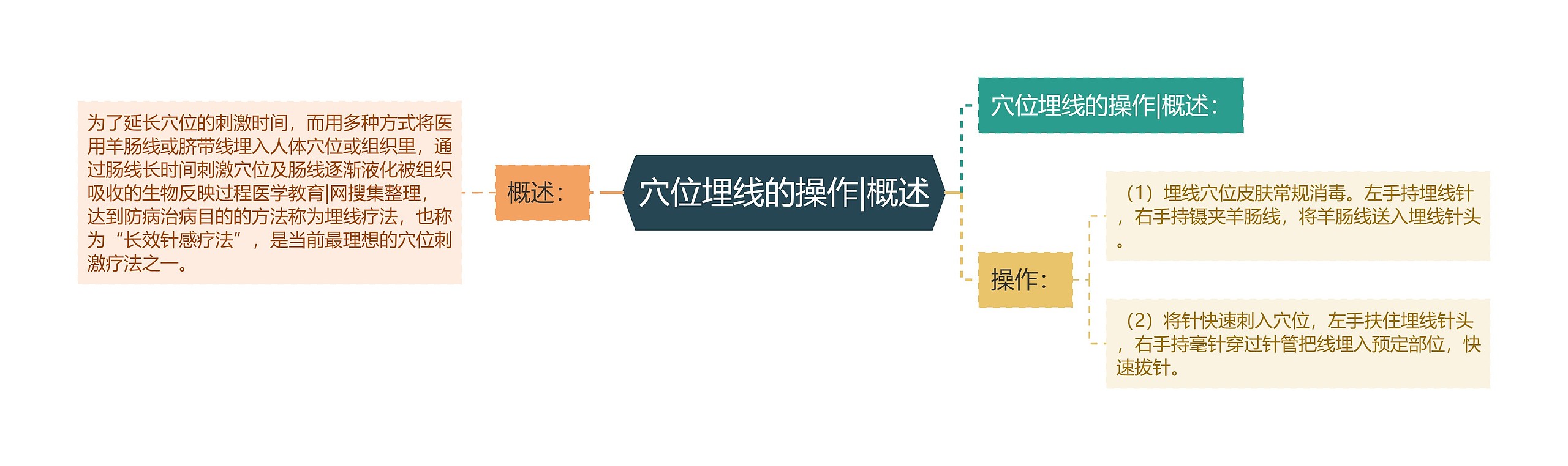 穴位埋线的操作|概述思维导图