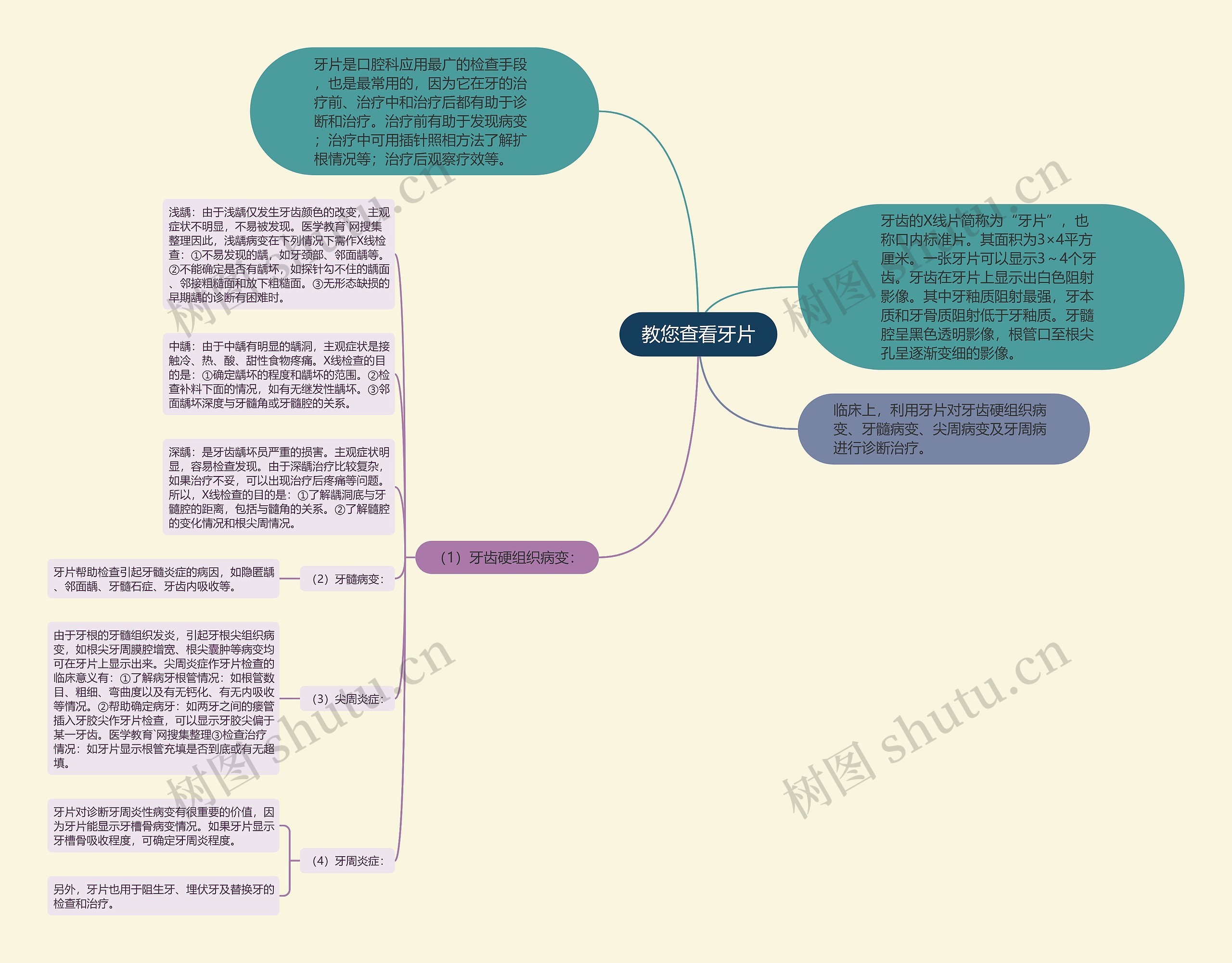 教您查看牙片思维导图