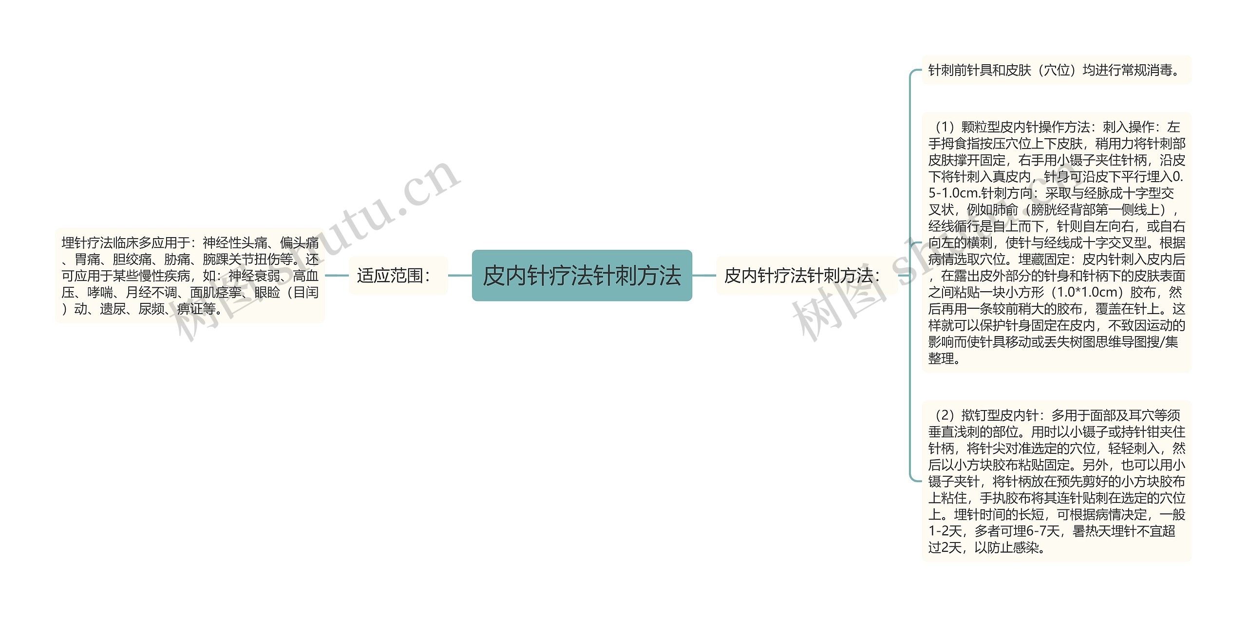 皮内针疗法针刺方法思维导图