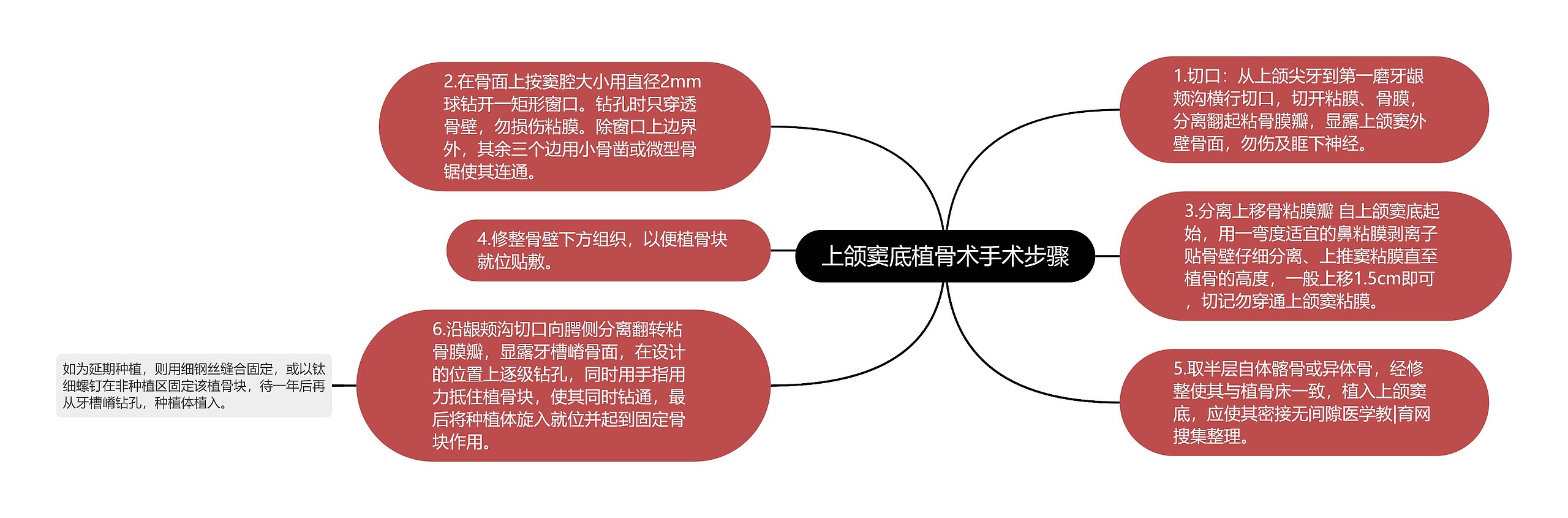 上颌窦底植骨术手术步骤 上颌窦底植骨术手术步骤