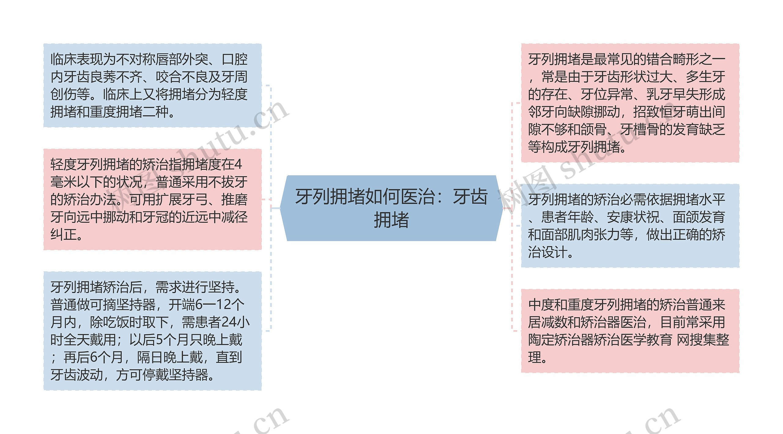 牙列拥堵如何医治：牙齿拥堵思维导图