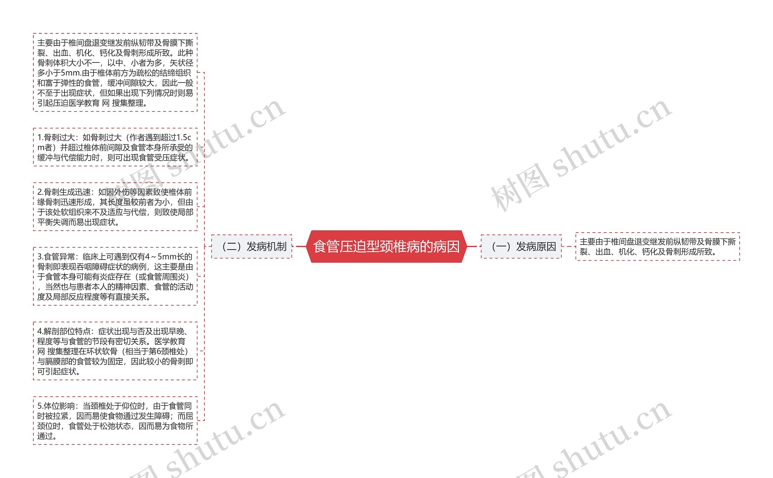 食管压迫型颈椎病的病因思维导图