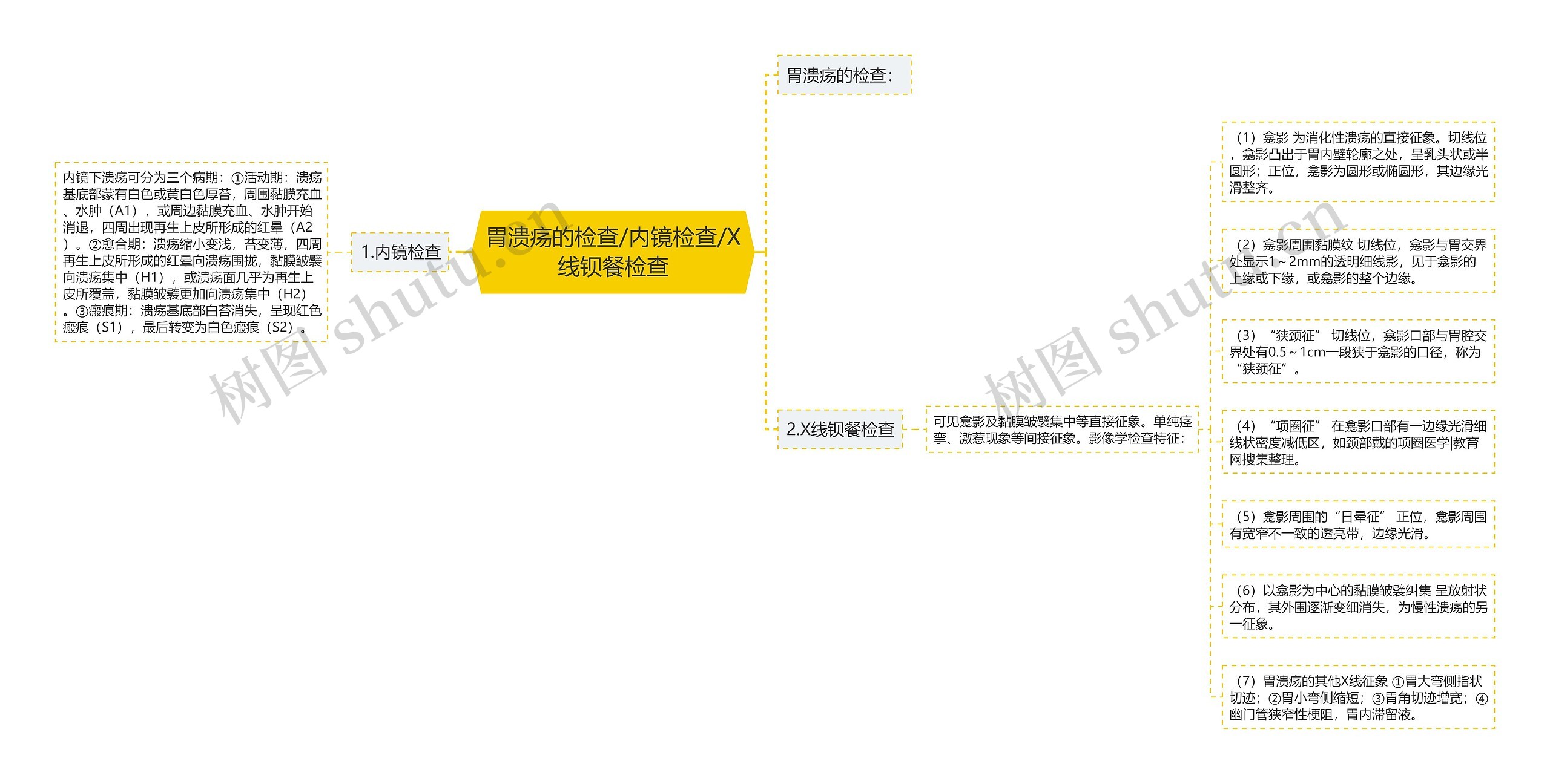 胃溃疡的检查/内镜检查/X线钡餐检查思维导图