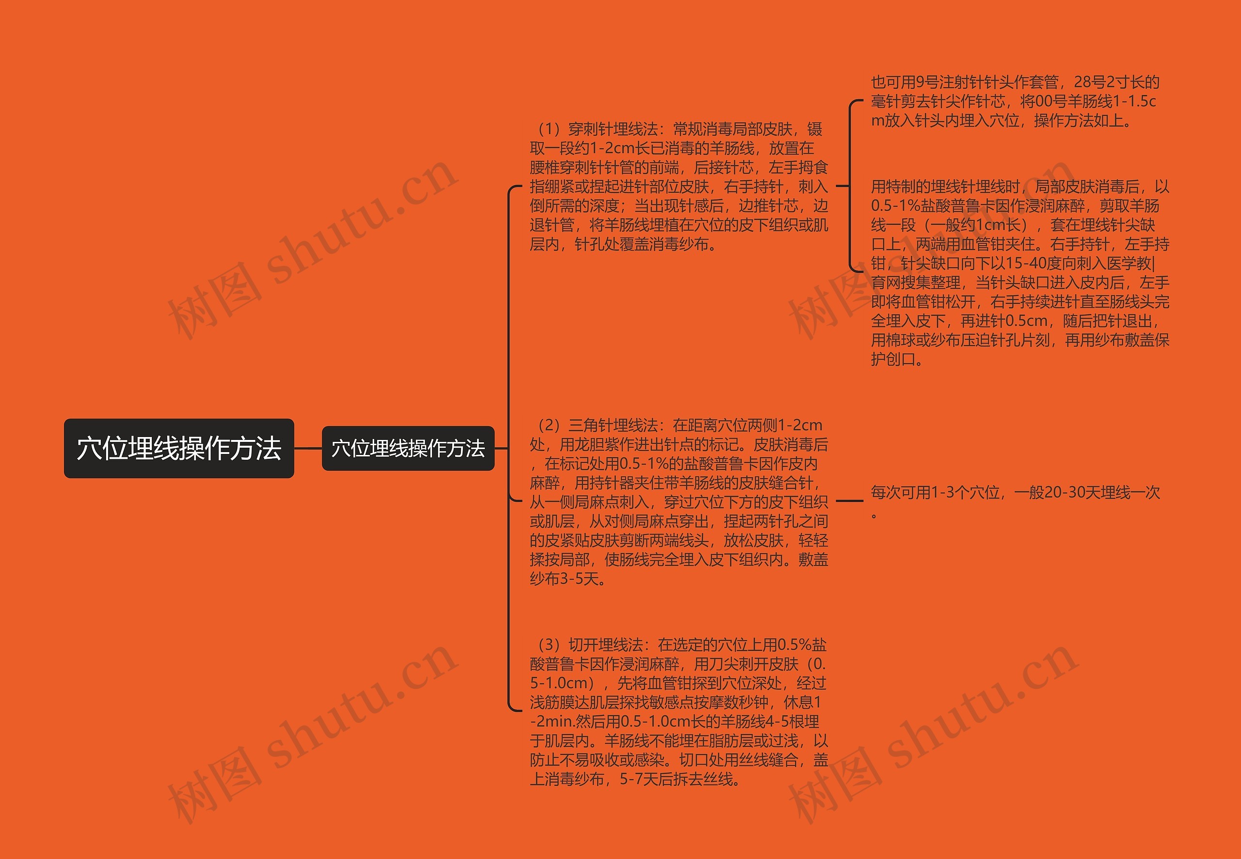 穴位埋线操作方法思维导图