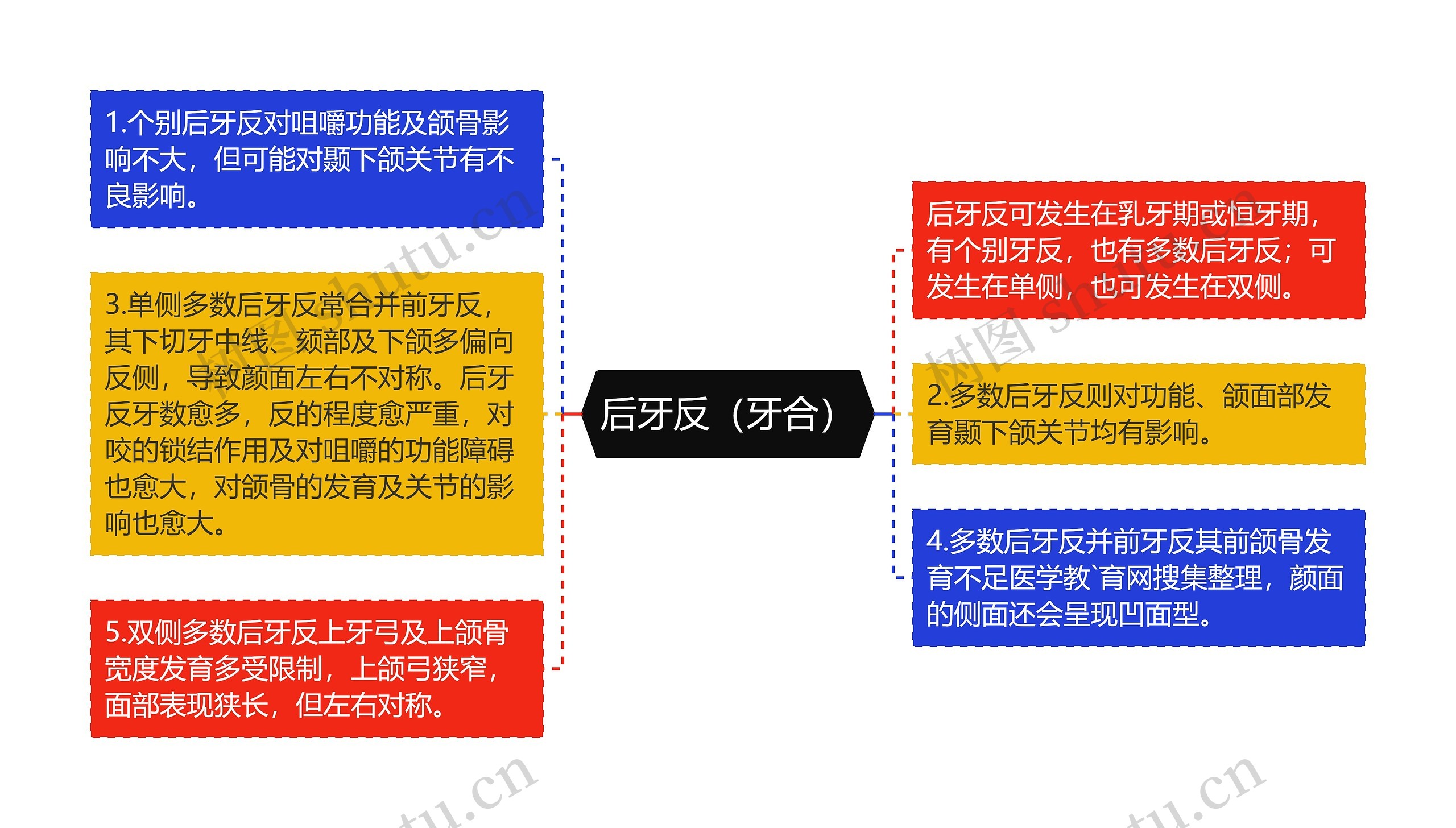 后牙反（牙合）思维导图