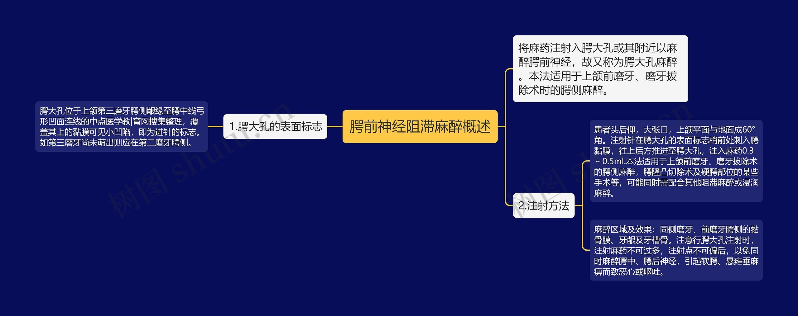 腭前神经阻滞麻醉概述思维导图