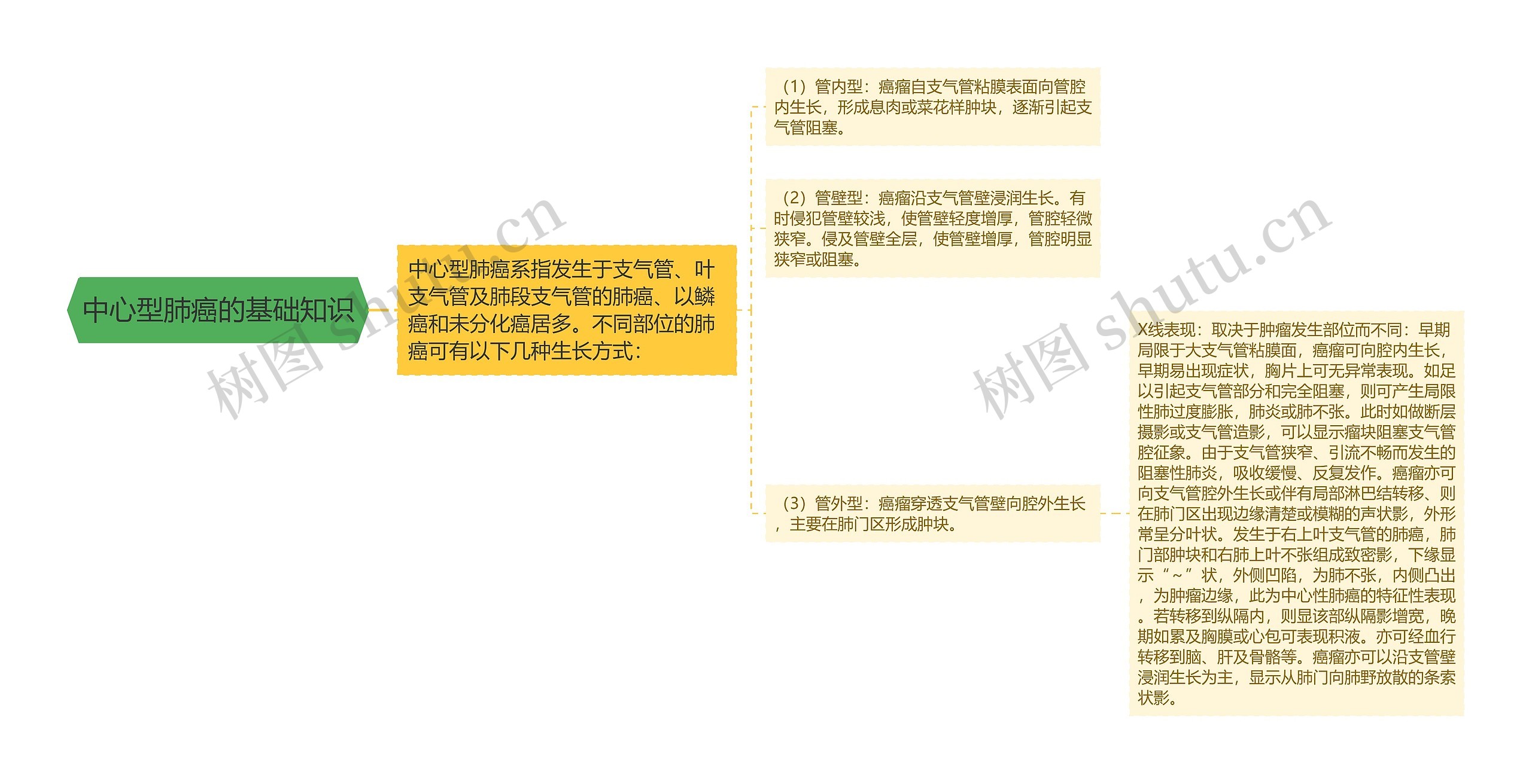 中心型肺癌的基础知识 中心型肺癌的基础知识