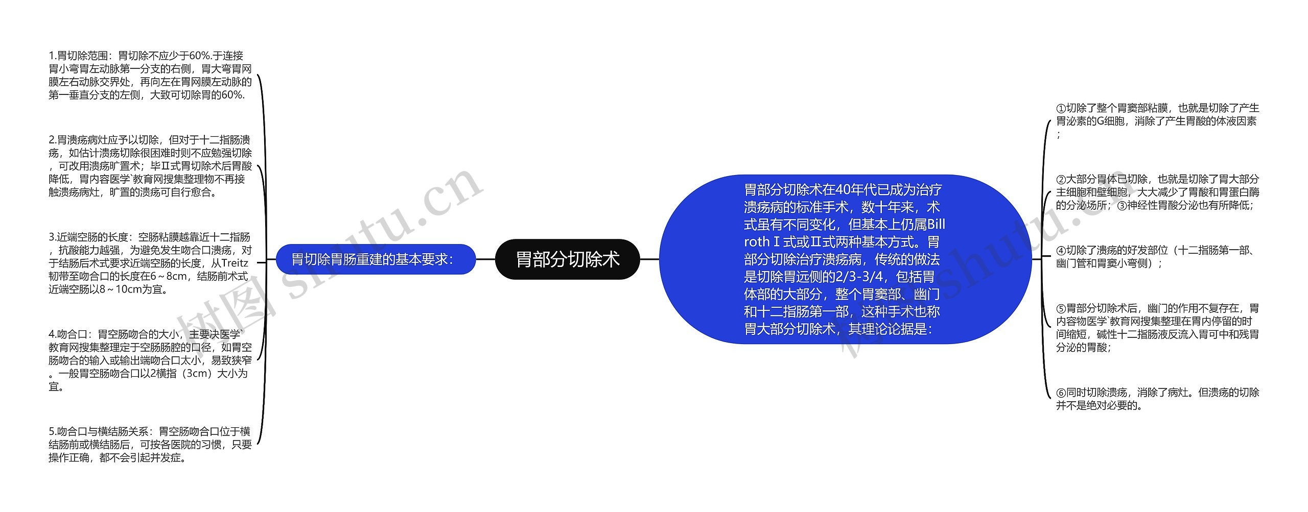 胃部分切除术思维导图