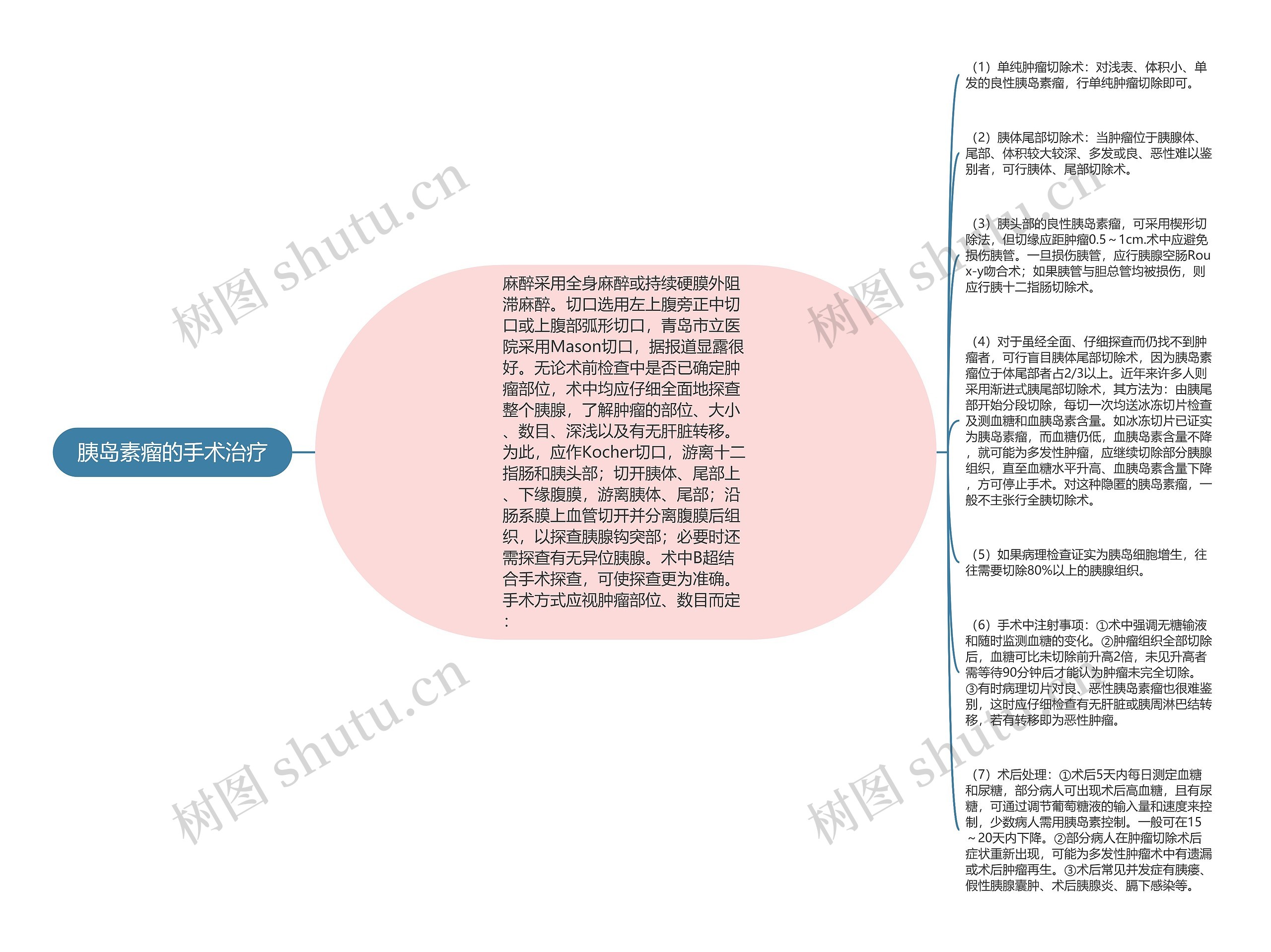 胰岛素瘤的手术治疗思维导图