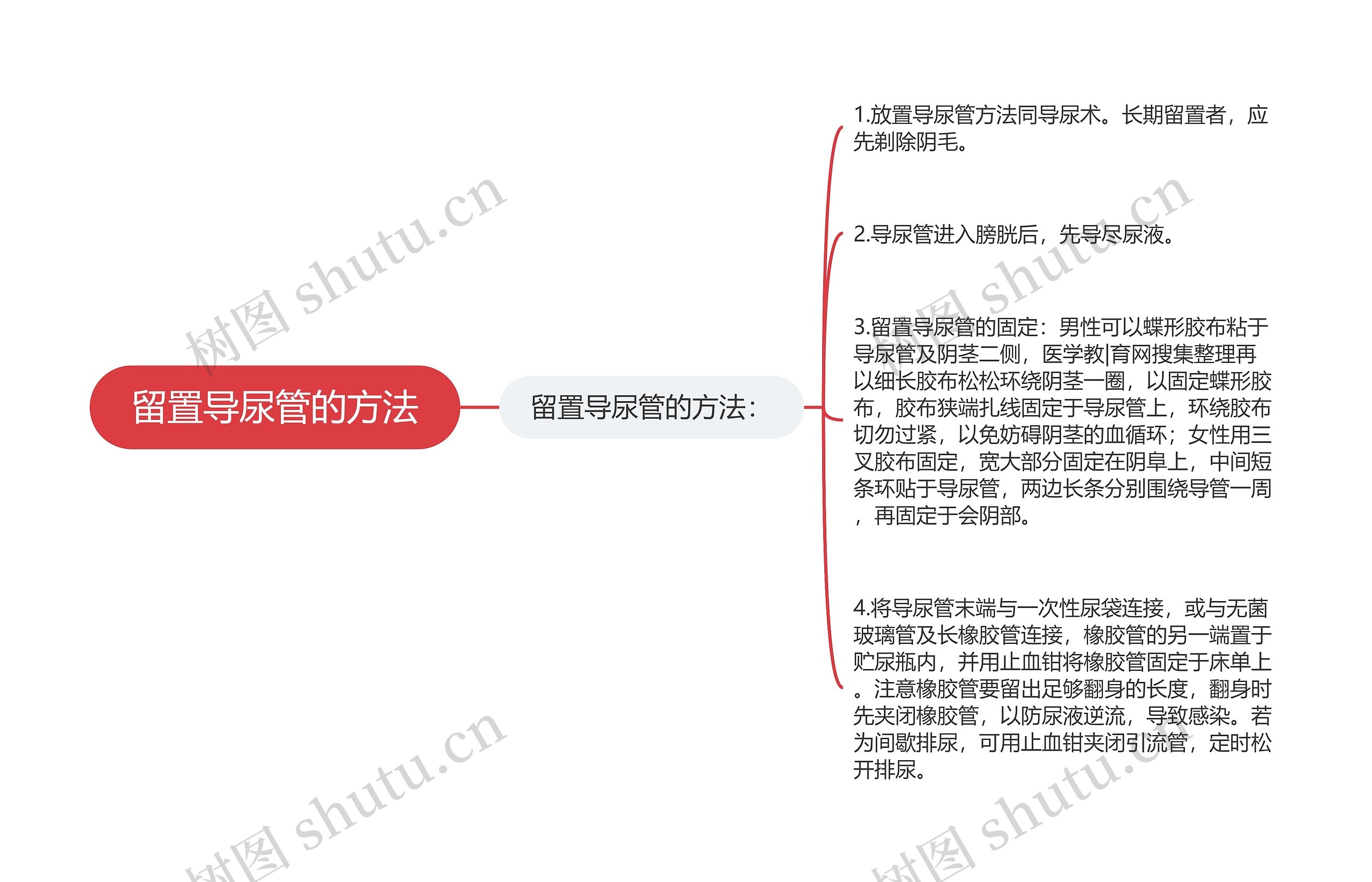 留置导尿管的方法