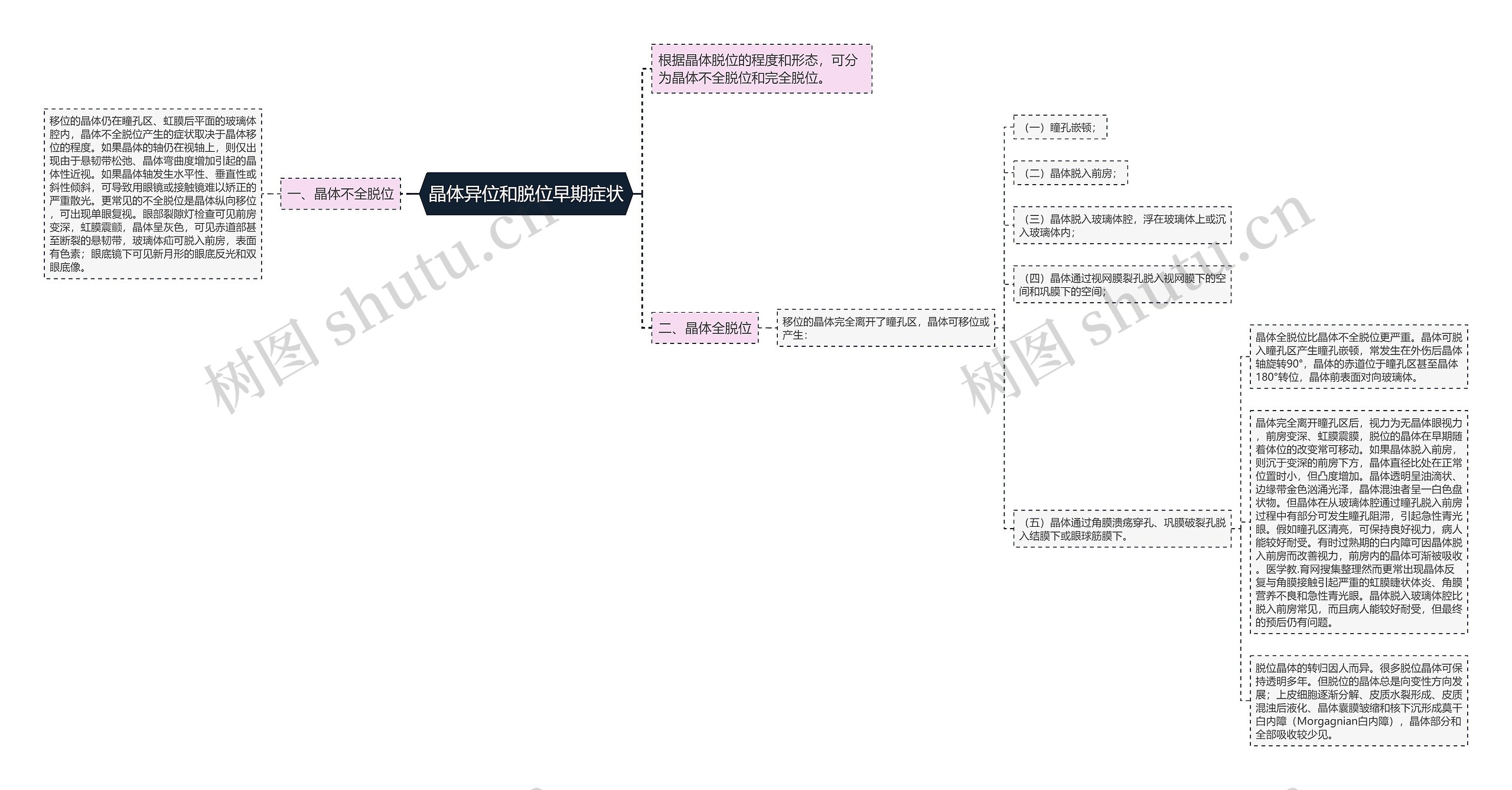 晶体异位和脱位早期症状思维导图