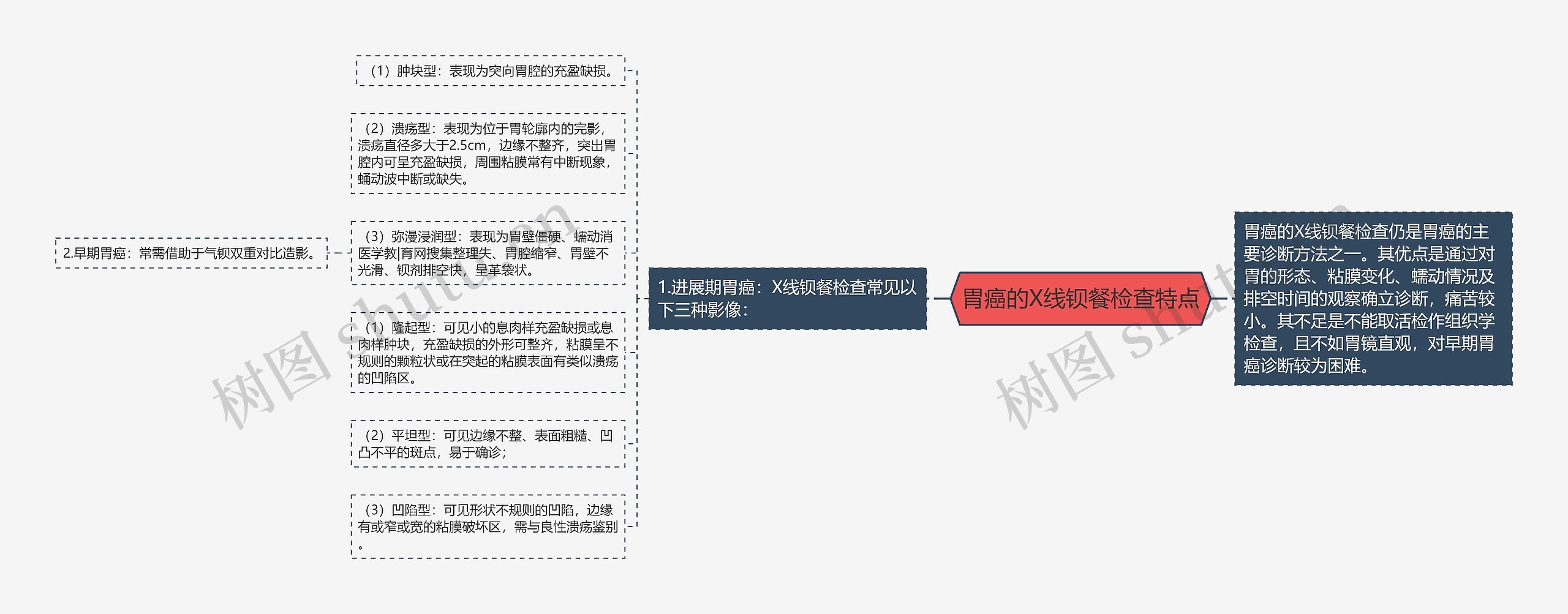 胃癌的X线钡餐检查特点