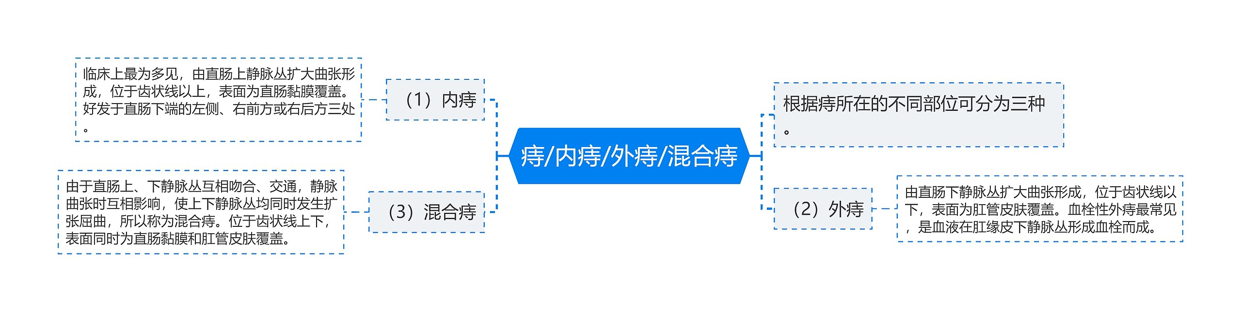 痔/内痔/外痔/混合痔思维导图