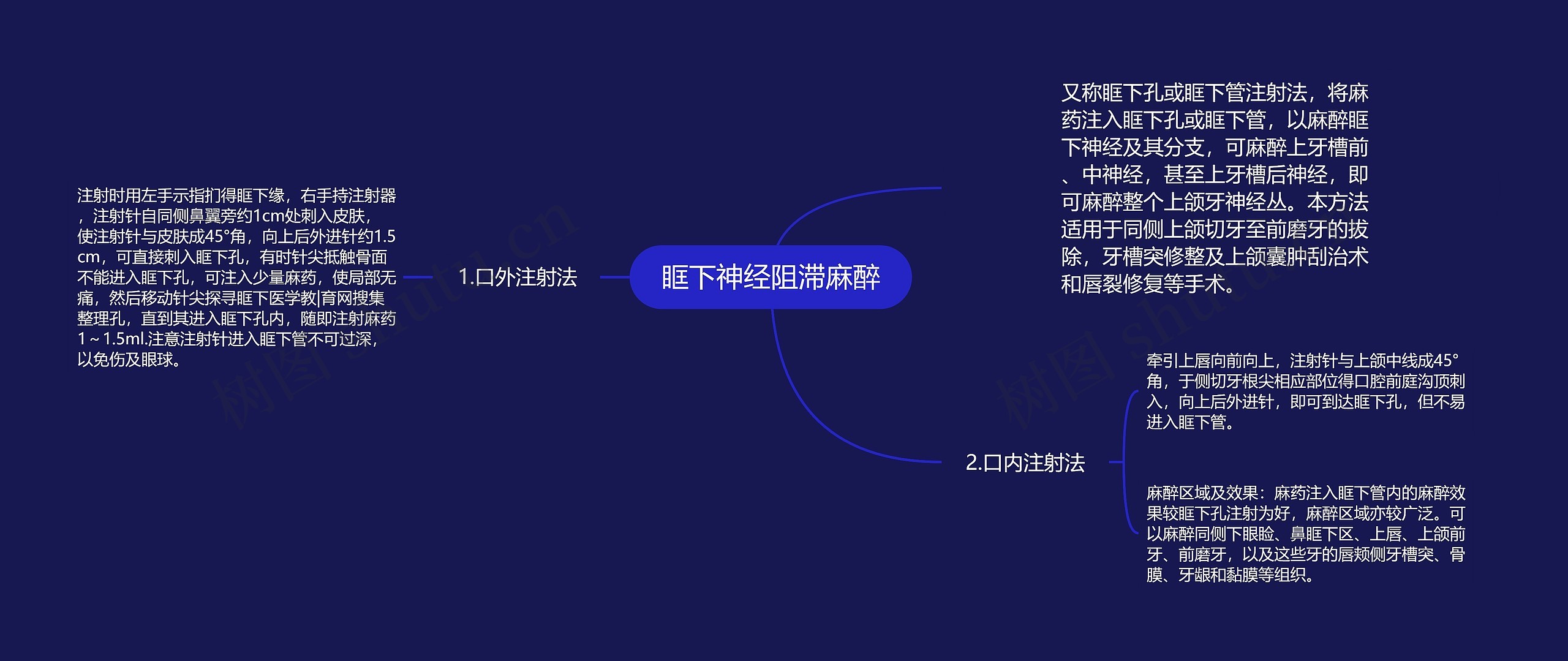 眶下神经阻滞麻醉思维导图