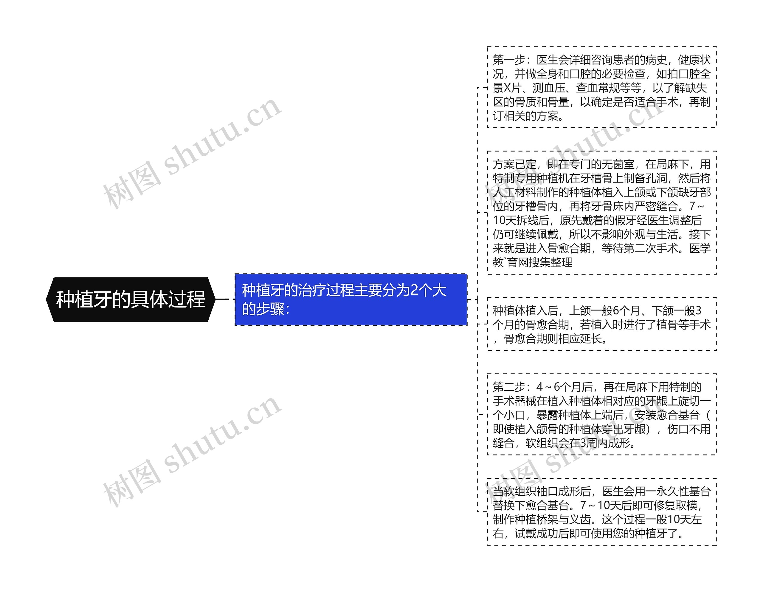 种植牙的具体过程思维导图