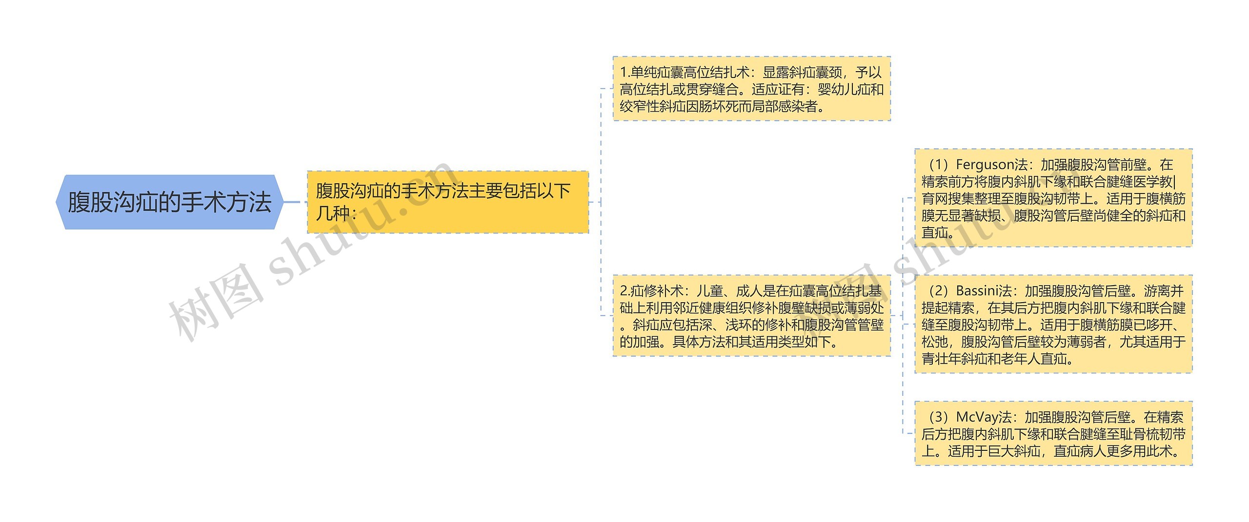 腹股沟疝的手术方法