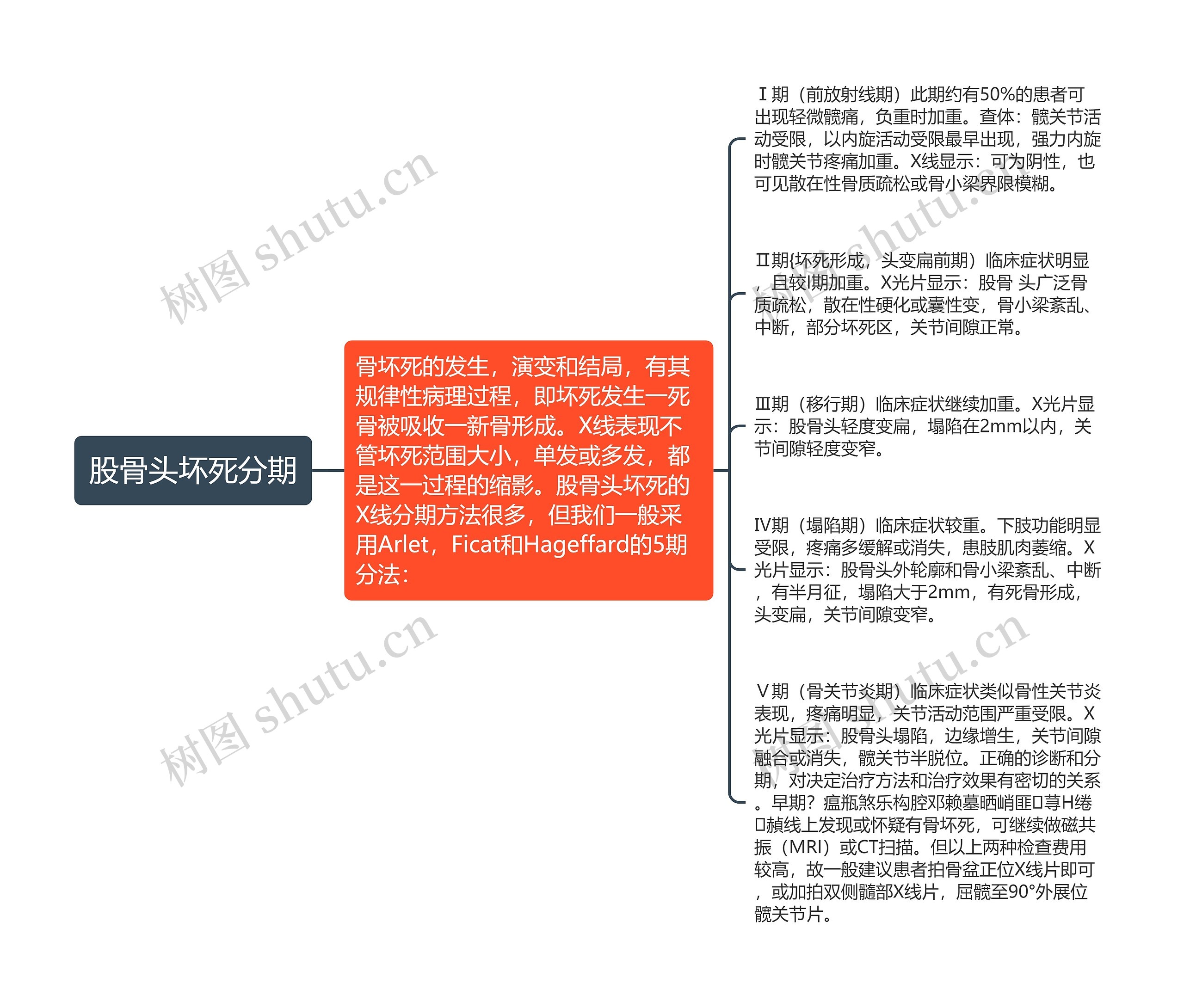 股骨头坏死分期 股骨头坏死分期