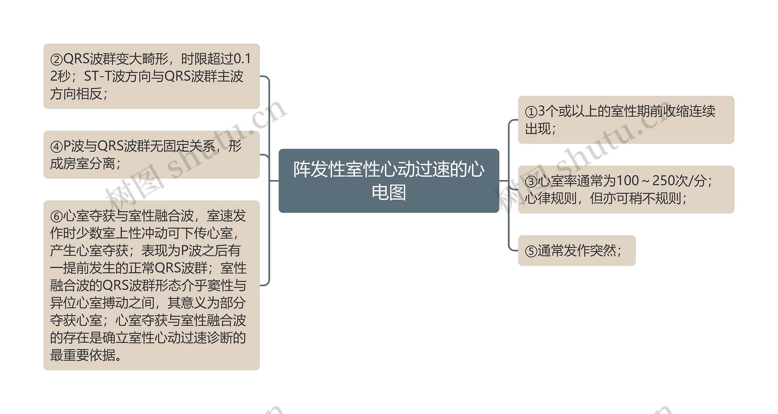 阵发性室性心动过速的心电图思维导图