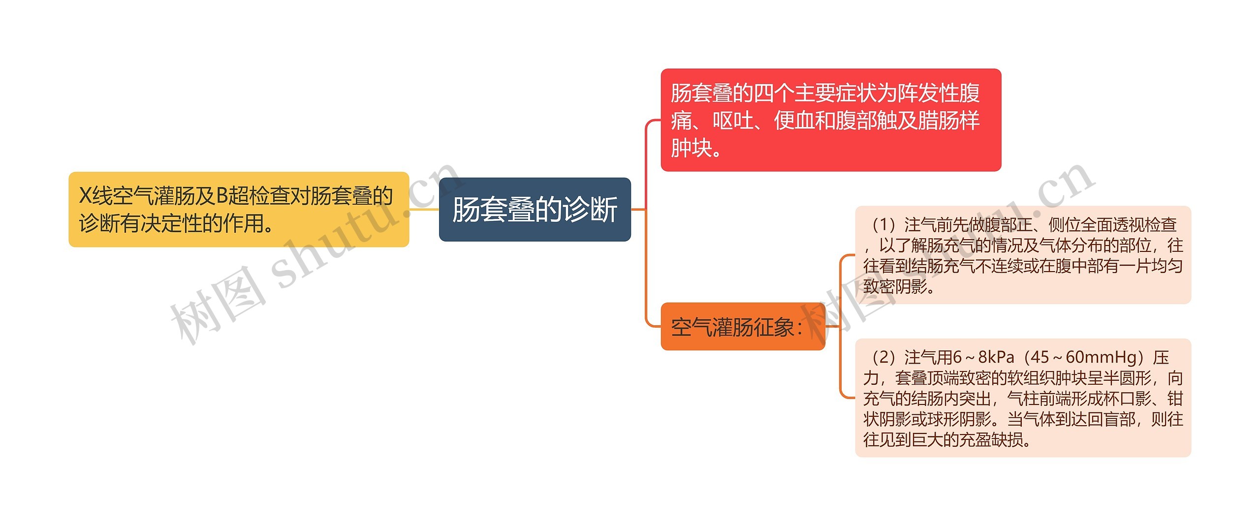 肠套叠的诊断