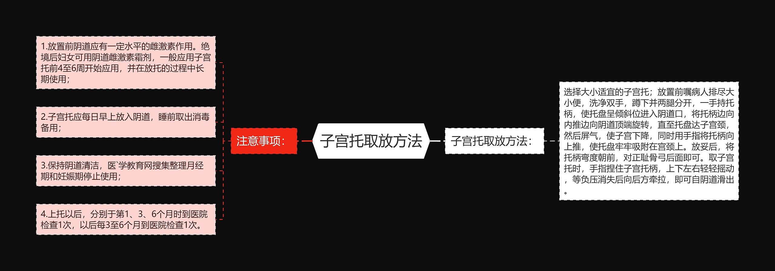 子宫托取放方法思维导图