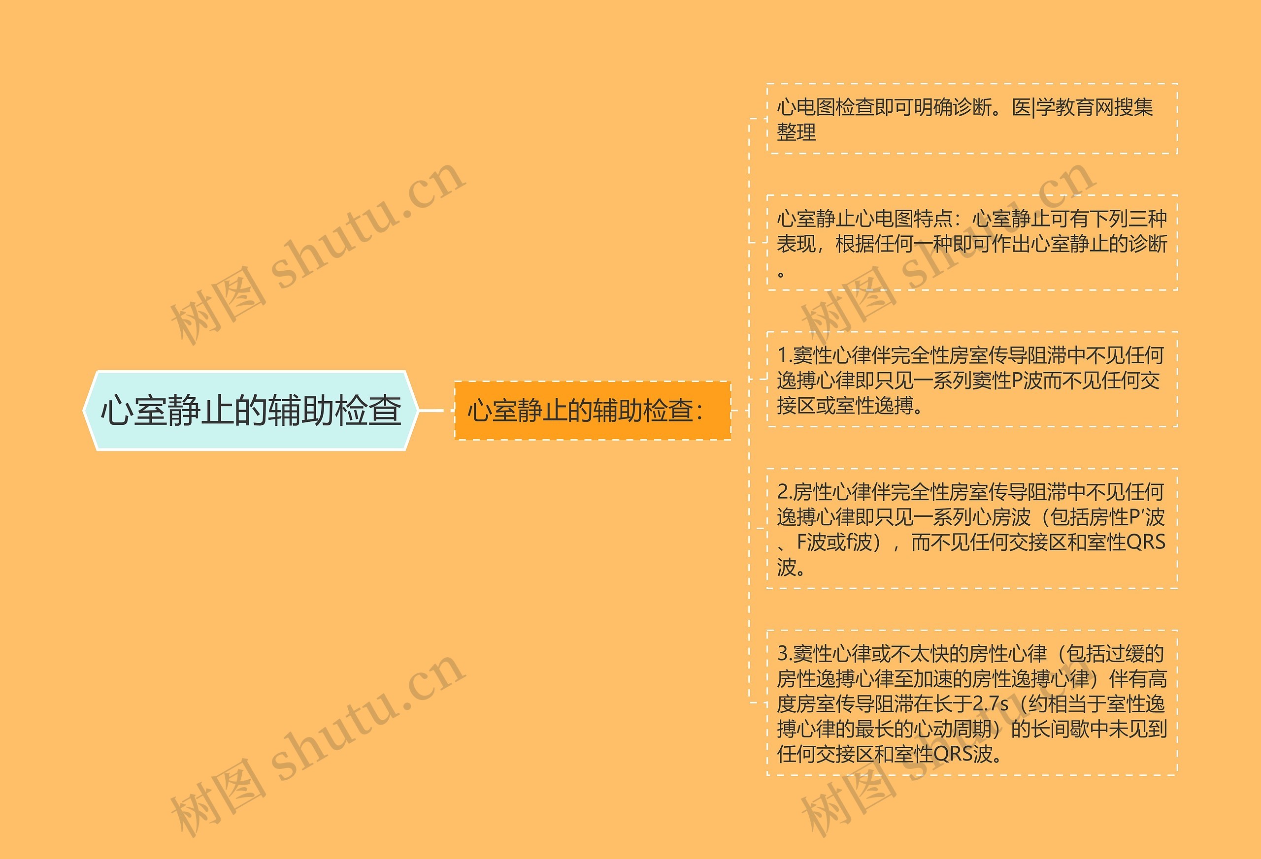 心室静止的辅助检查 心室静止的辅助检查
