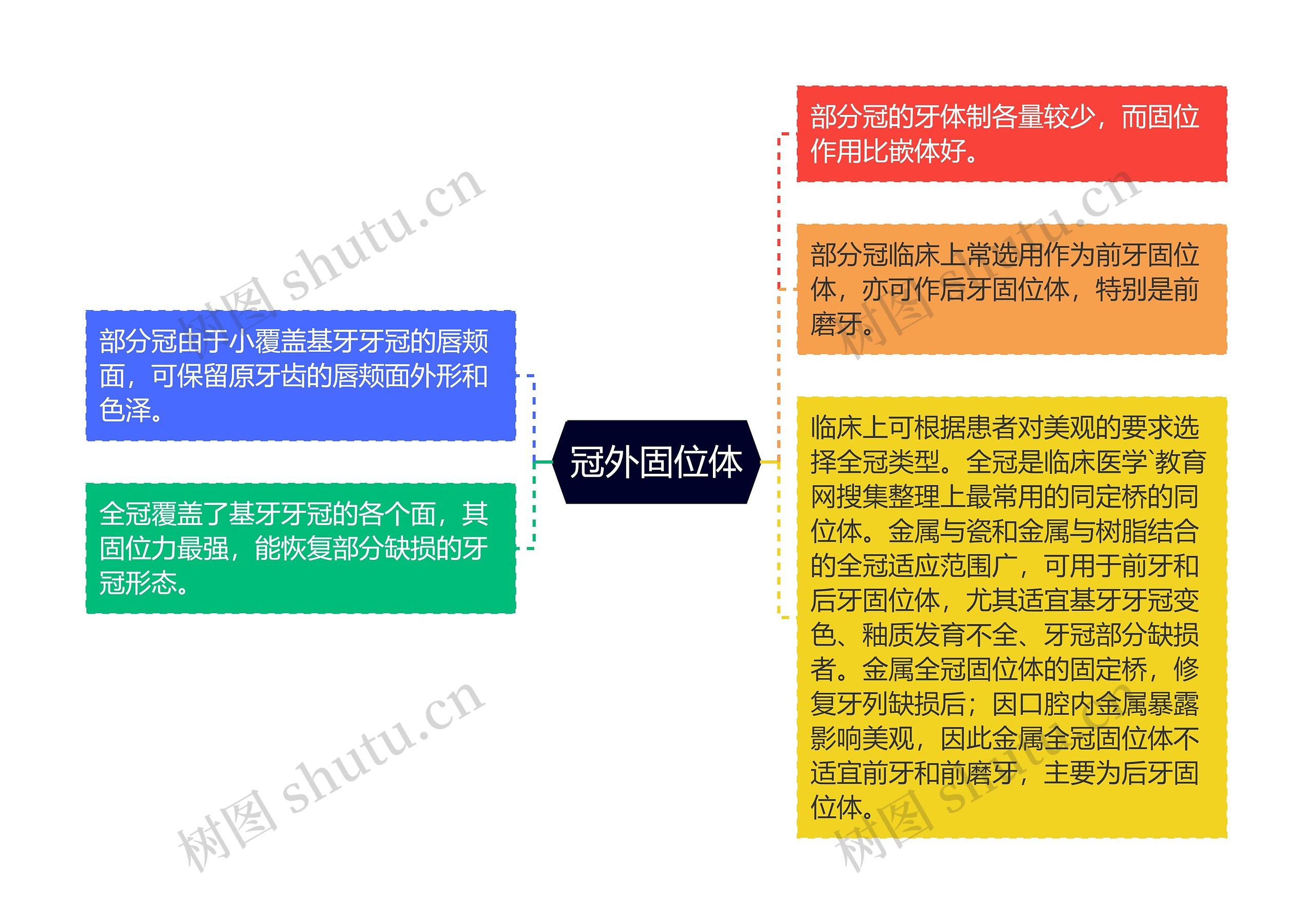 冠外固位体 冠外固位体