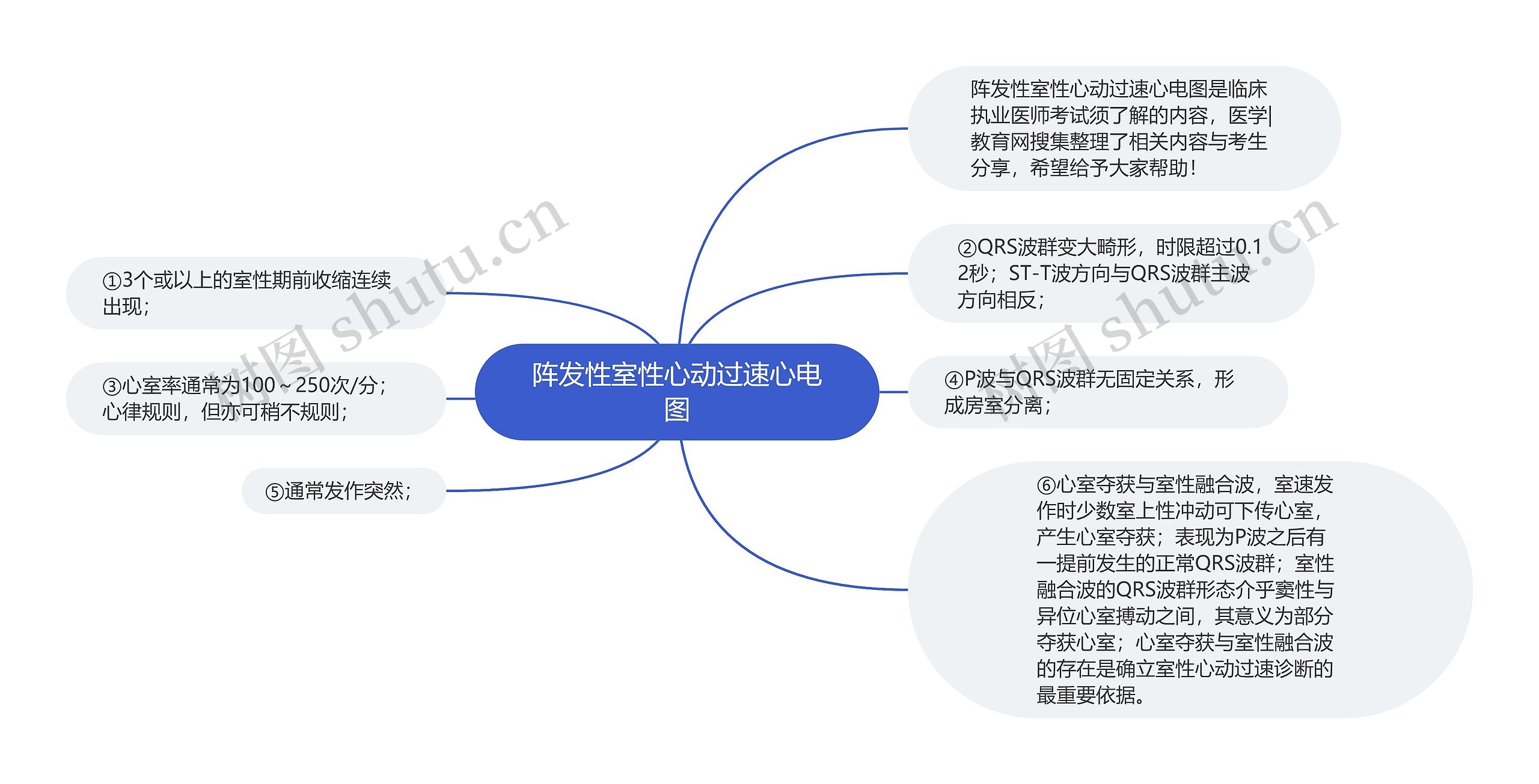 阵发性室性心动过速心电图