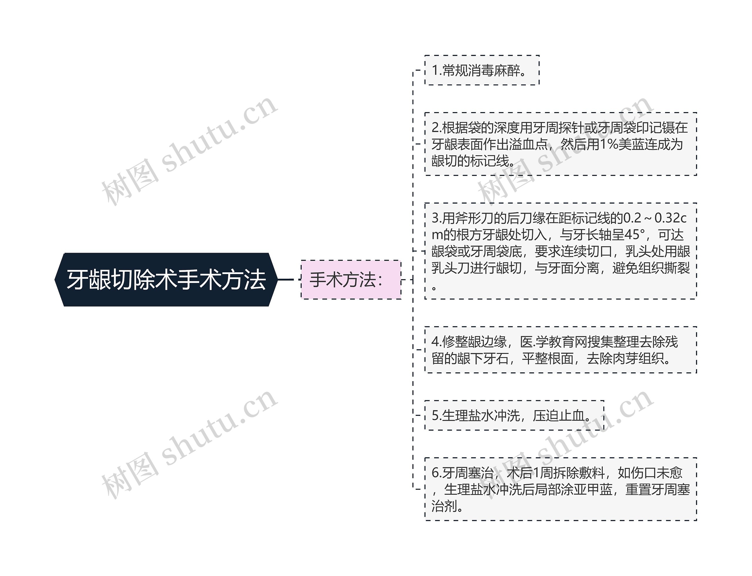 牙龈切除术手术方法思维导图