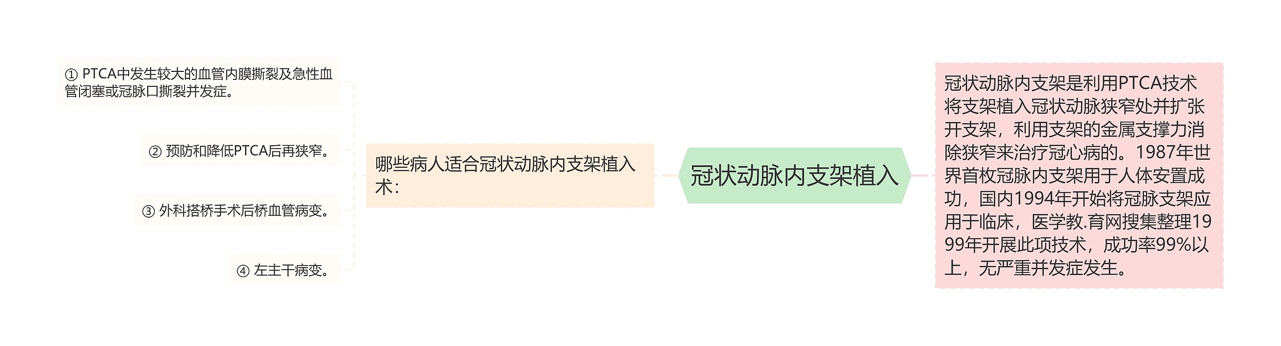 冠状动脉内支架植入 冠状动脉内支架植入