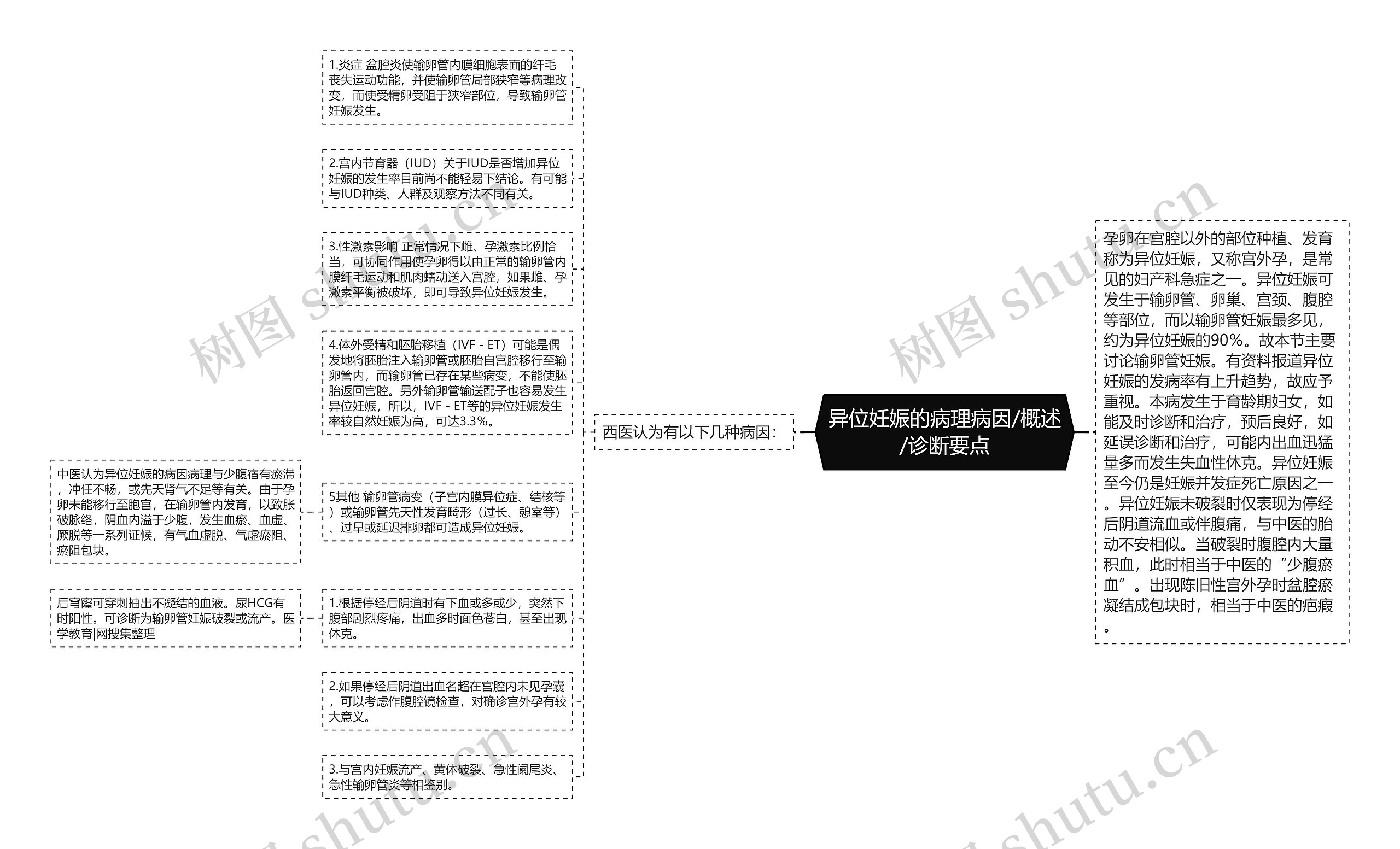 异位妊娠的病理病因/概述/诊断要点思维导图