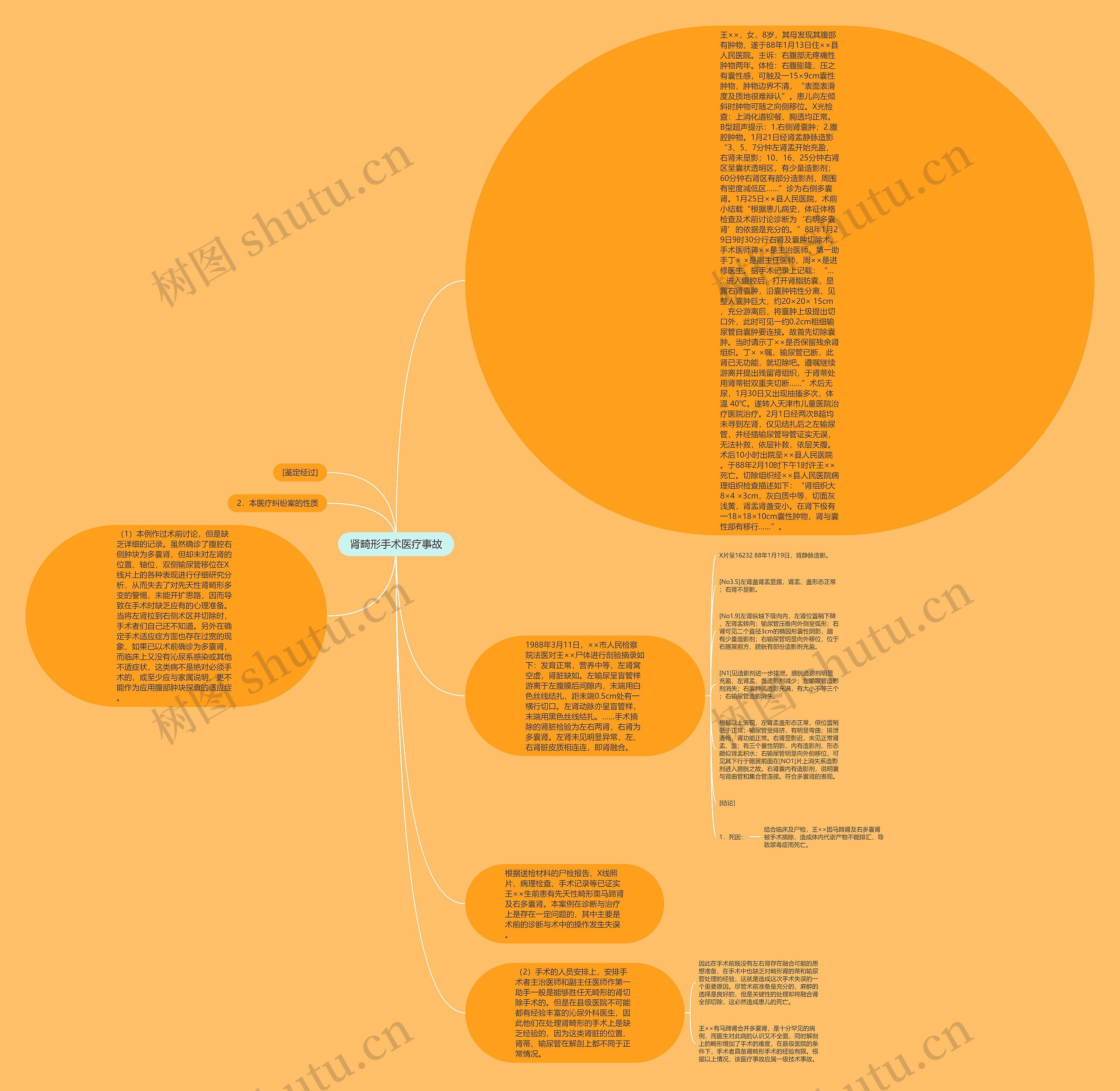 肾畸形手术医疗事故思维导图