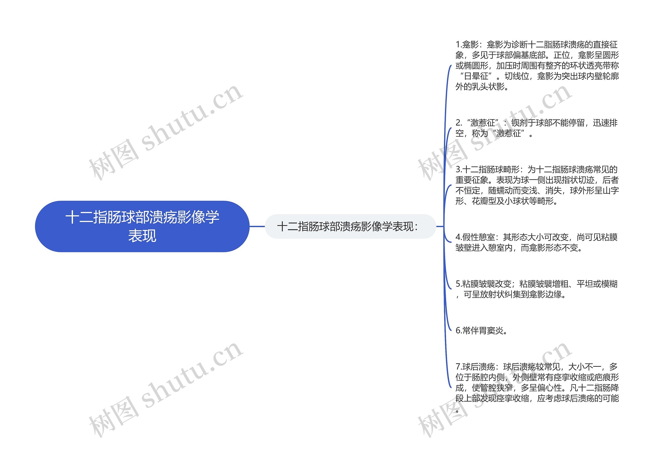 十二指肠球部溃疡影像学表现思维导图