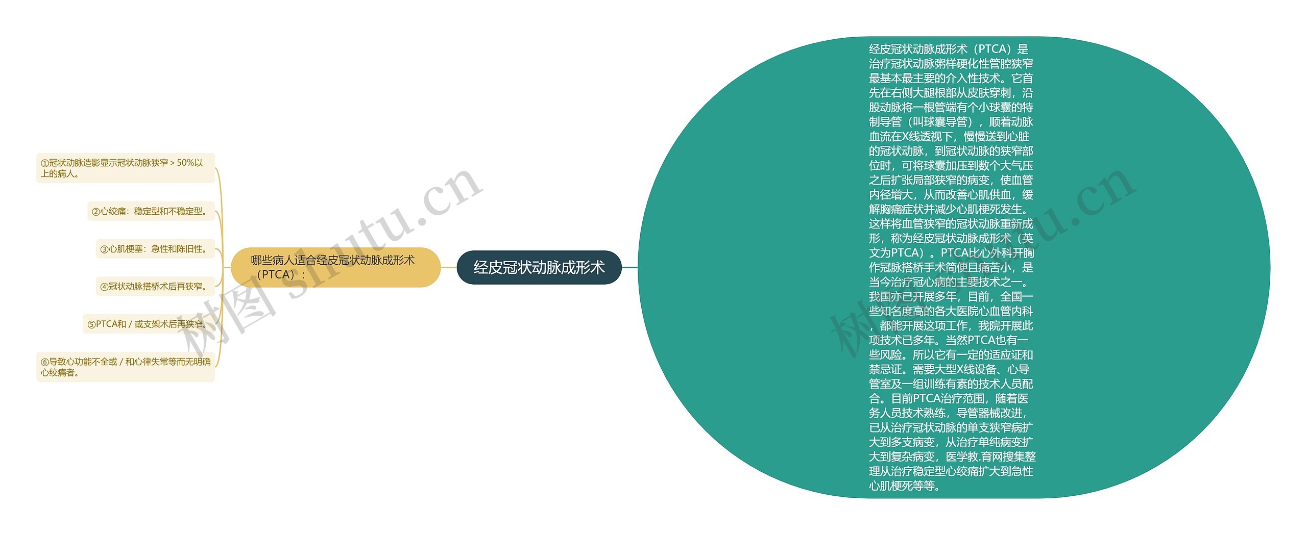 经皮冠状动脉成形术思维导图