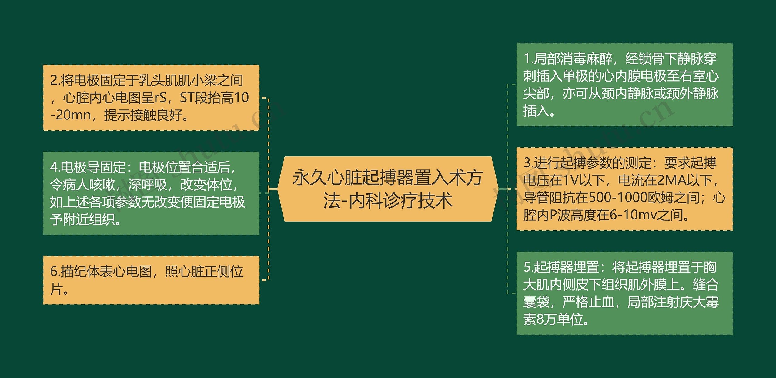 永久心脏起搏器置入术方法-内科诊疗技术思维导图