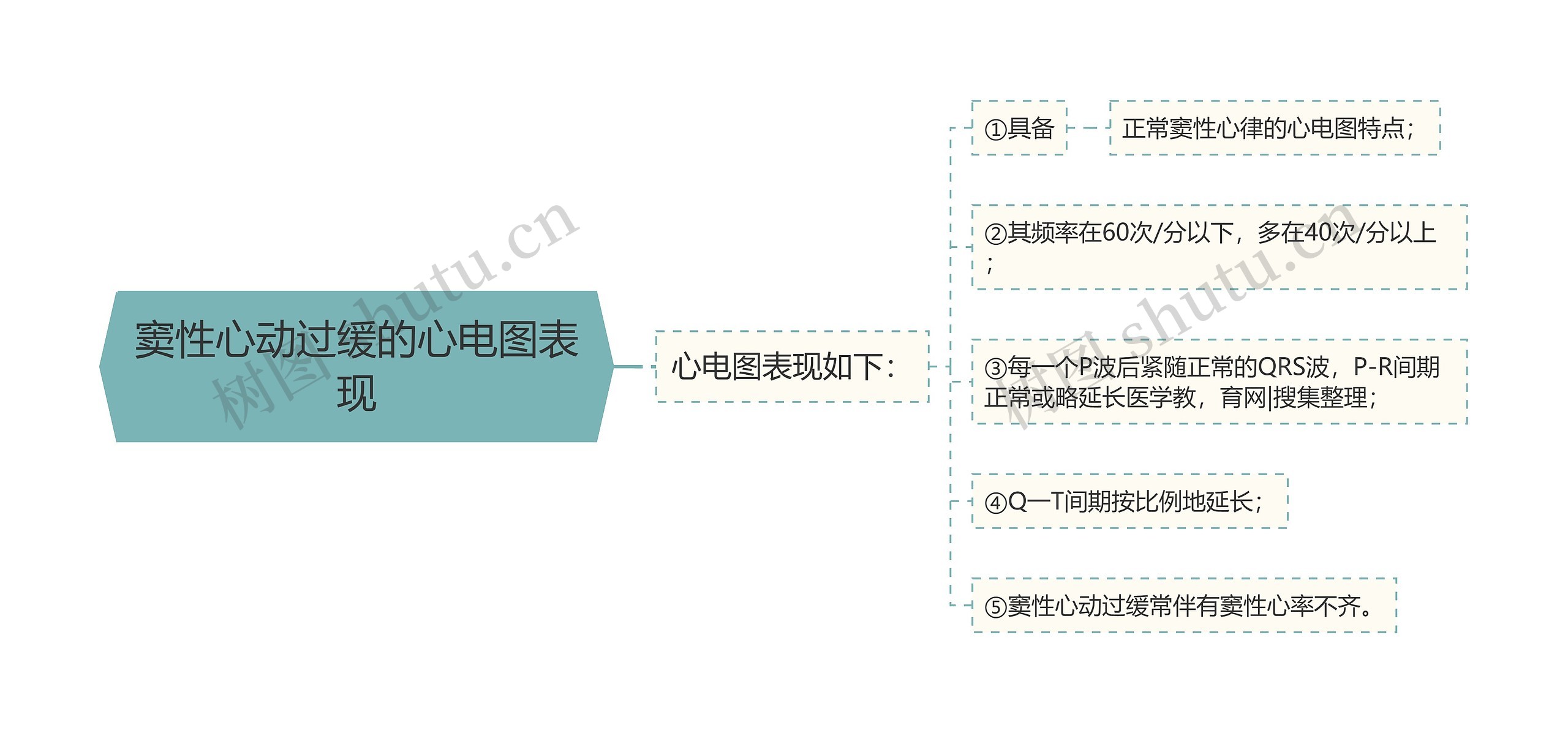 窦性心动过缓的心电图表现