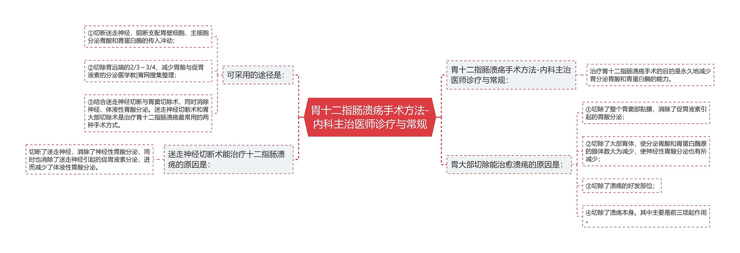 胃十二指肠溃疡手术方法-内科主治医师诊疗与常规思维导图