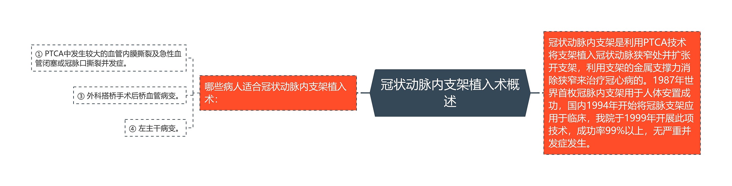 冠状动脉内支架植入术概述