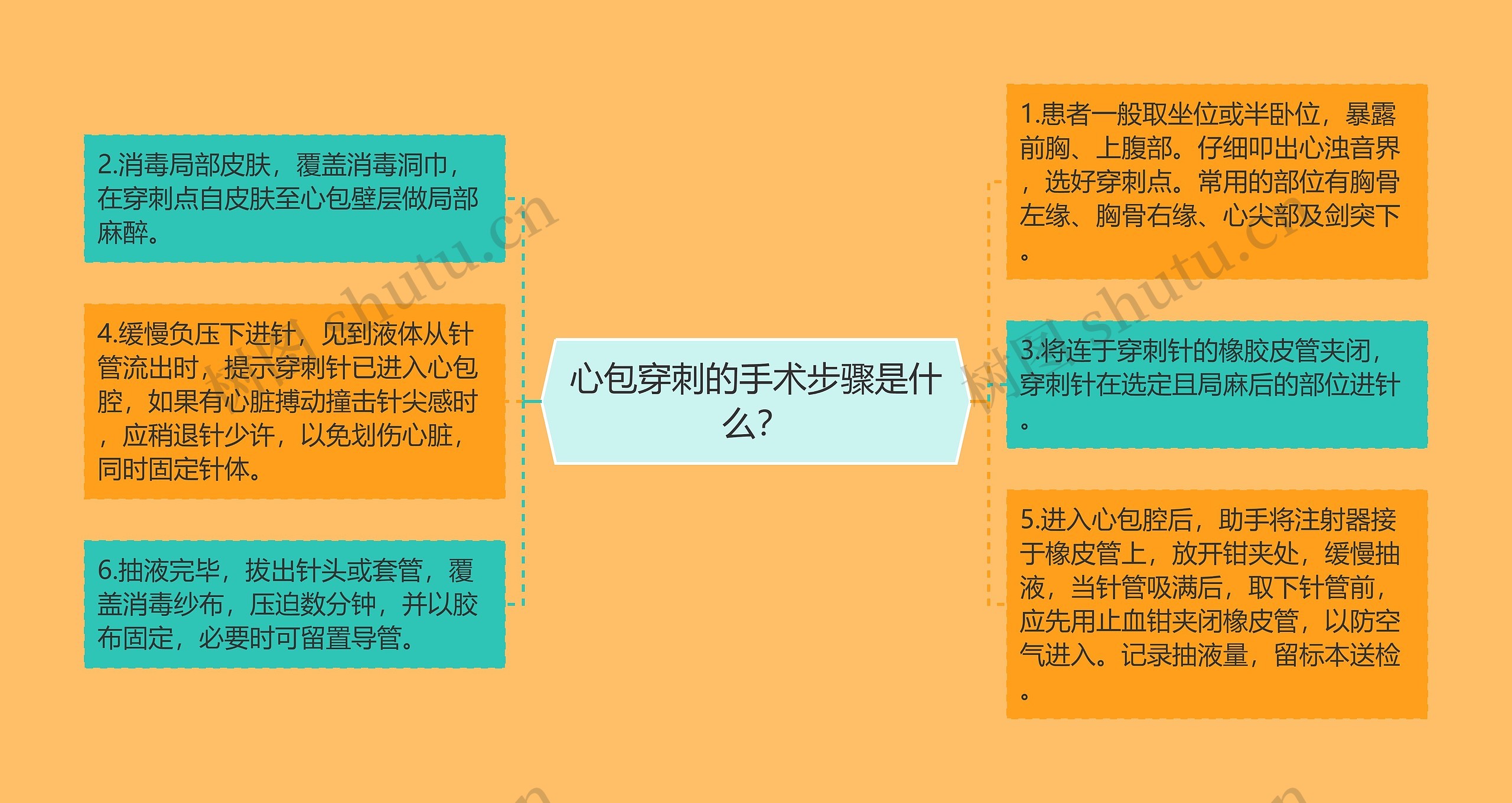 心包穿刺的手术步骤是什么？