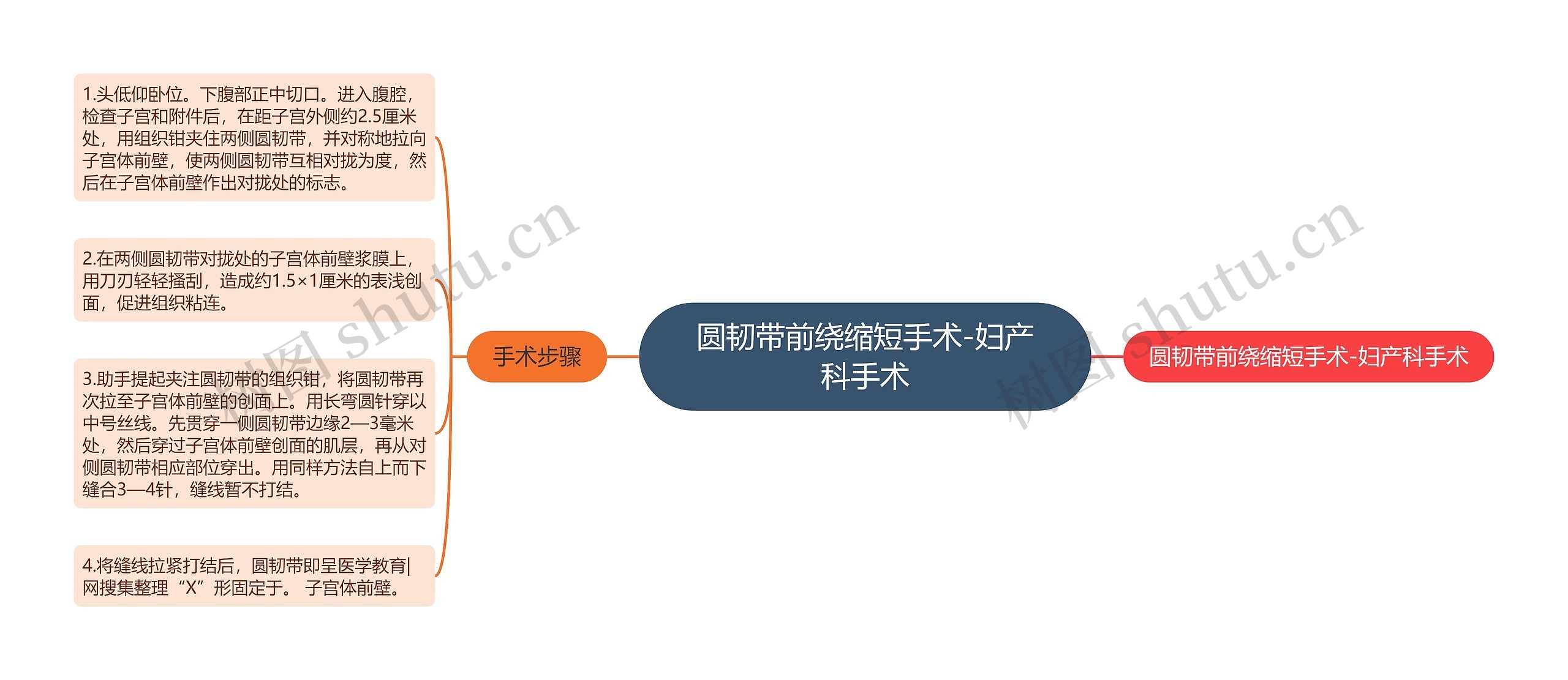 圆韧带前绕缩短手术-妇产科手术 圆韧带前绕缩短手术-妇产科手术