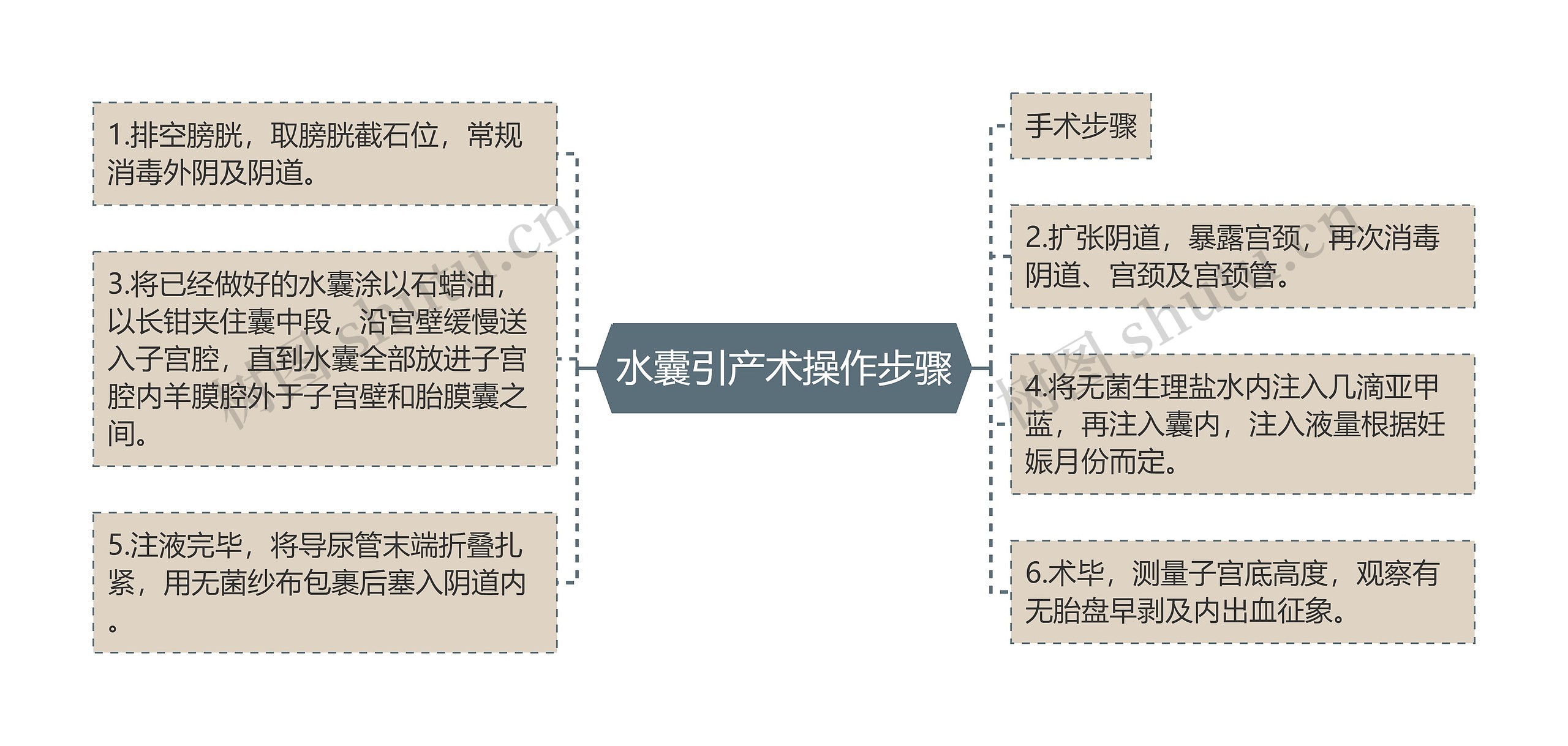 水囊引产术操作步骤