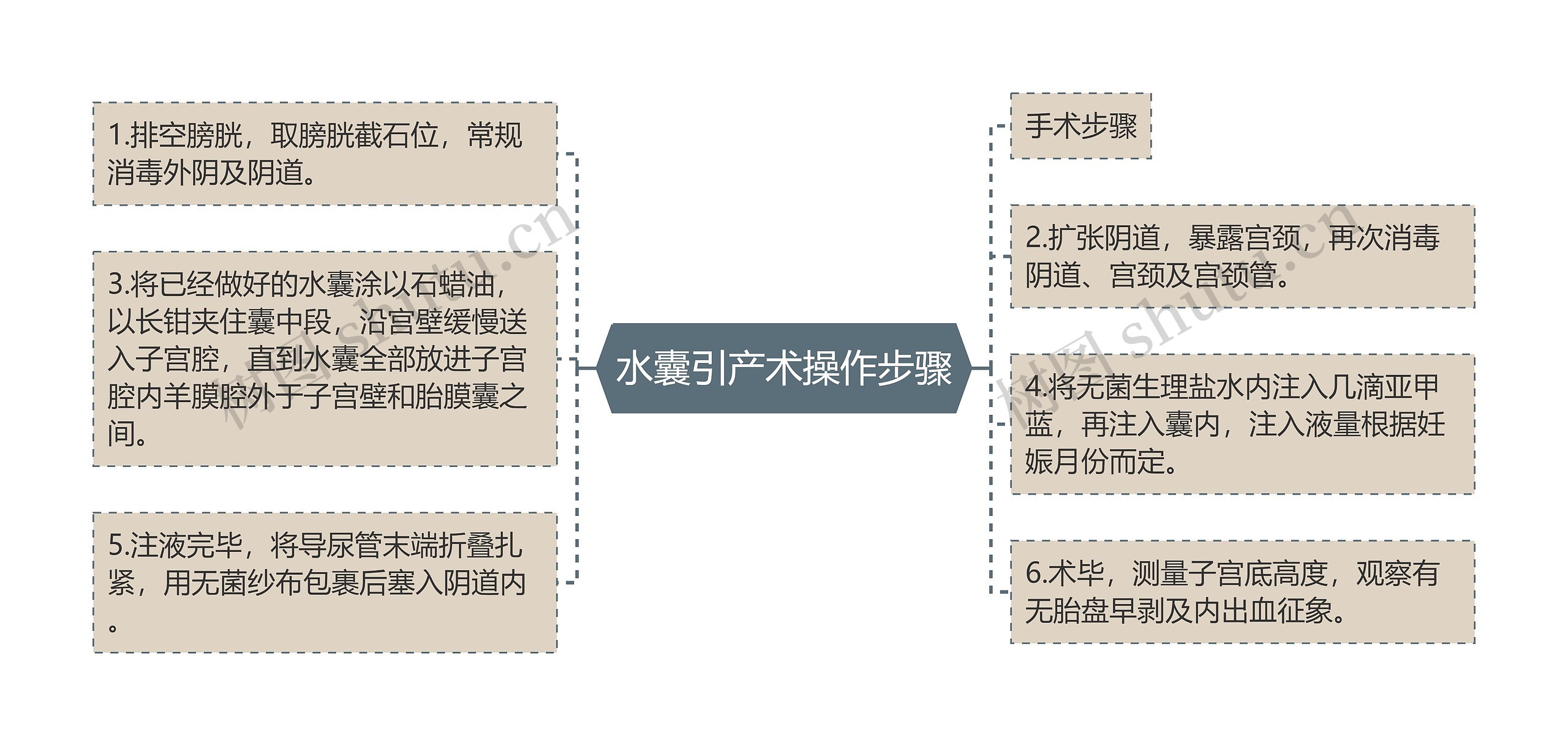 水囊引产术操作步骤思维导图