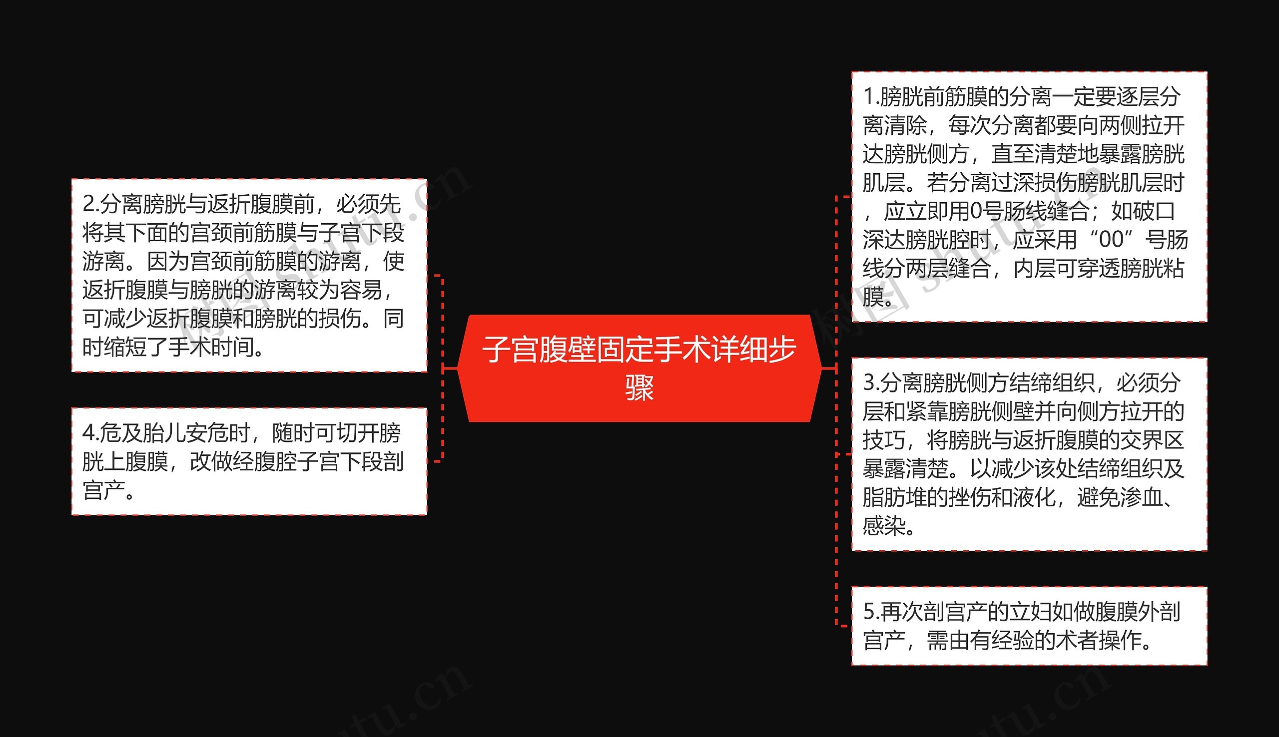 子宫腹壁固定手术详细步骤 子宫腹壁固定手术详细步骤