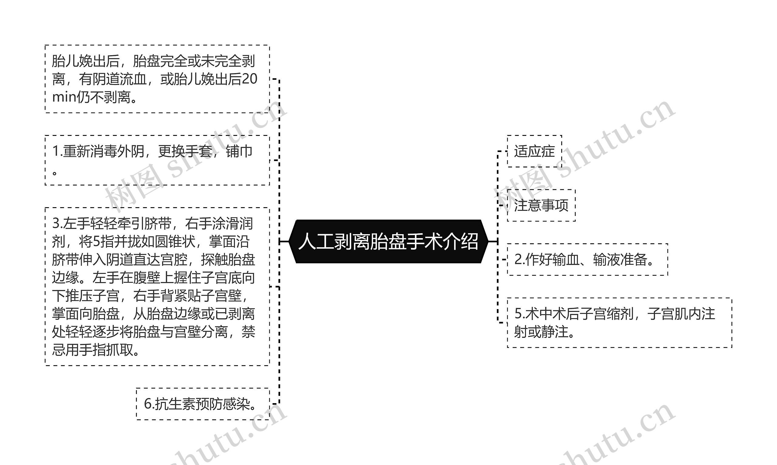 人工剥离胎盘手术介绍思维导图