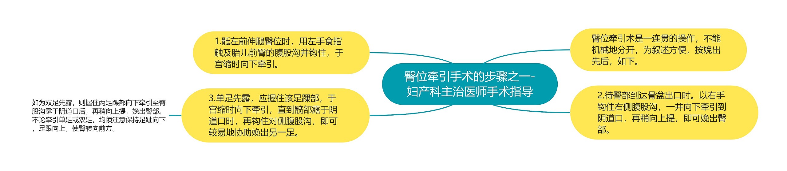 臀位牵引手术的步骤之一-妇产科主治医师手术指导思维导图