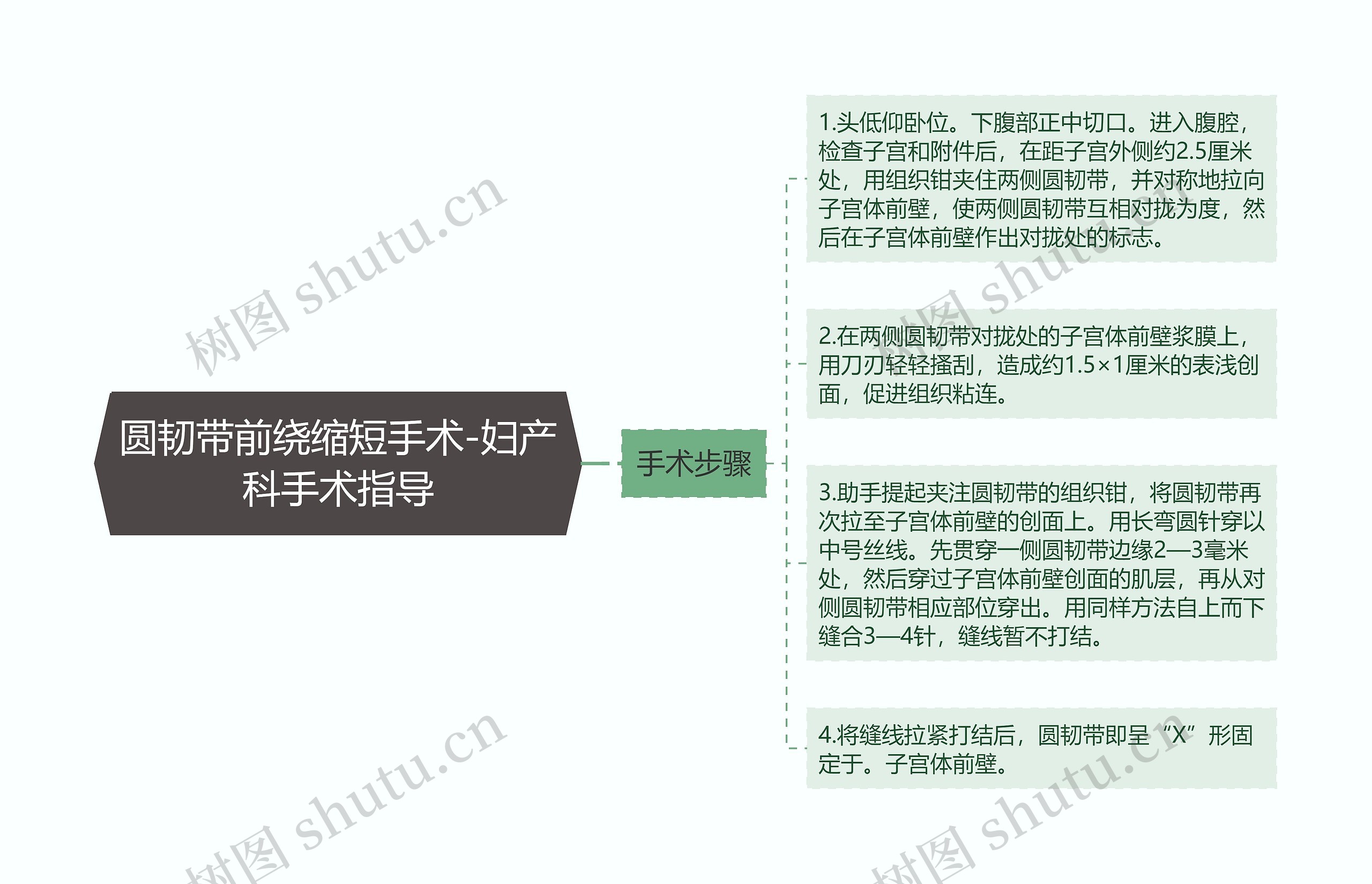 圆韧带前绕缩短手术-妇产科手术指导思维导图