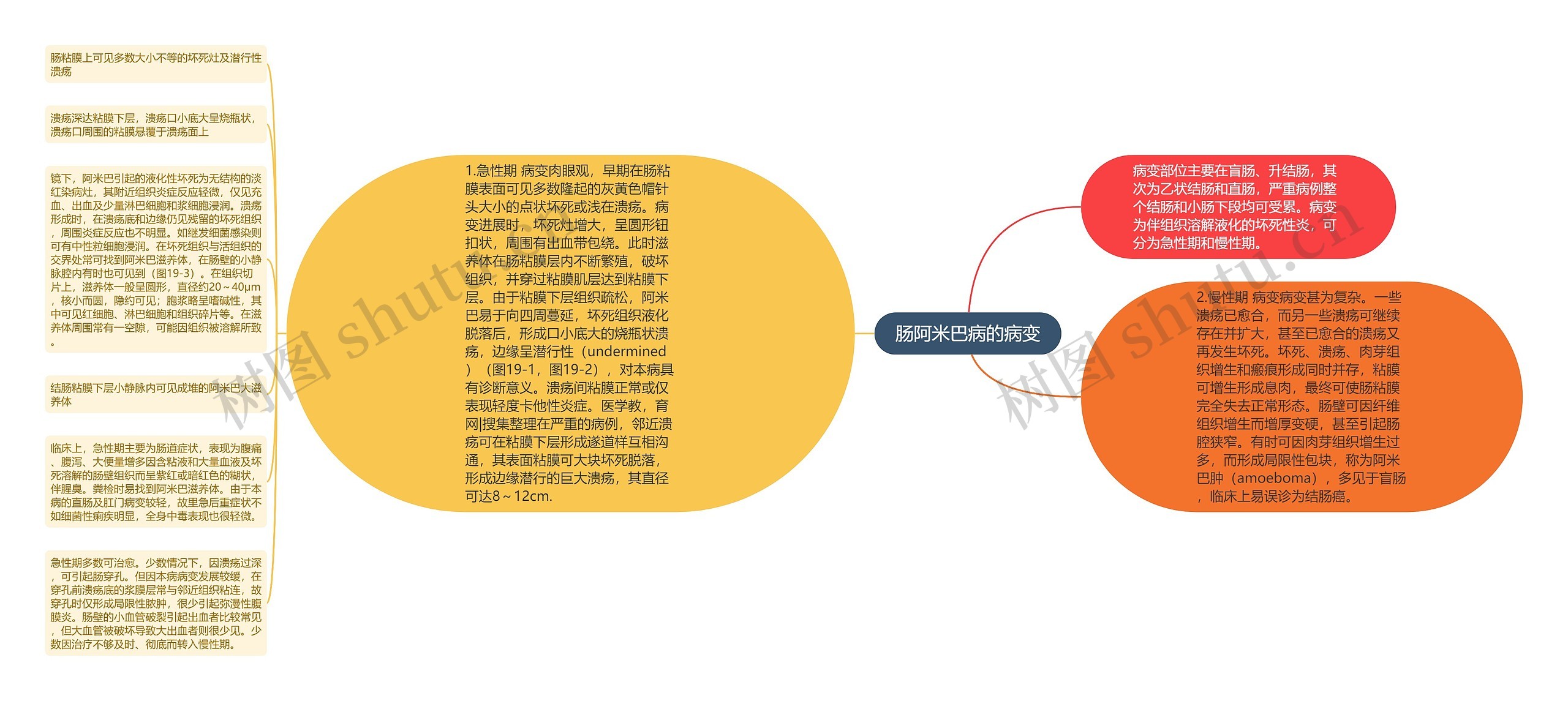 肠阿米巴病的病变 肠阿米巴病的病变
